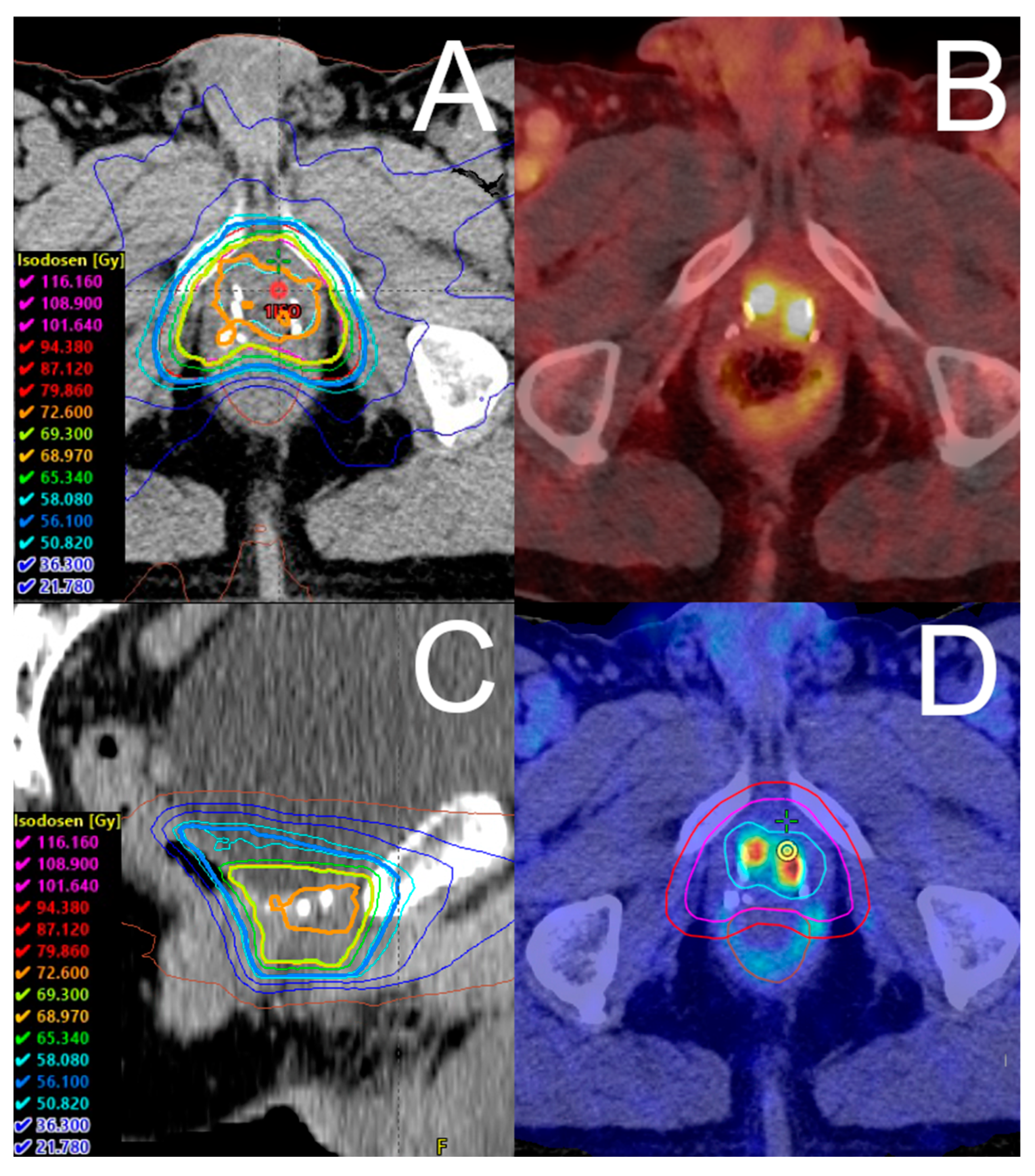 Cancers 14 04956 g001 Cancers 14 04956 g001