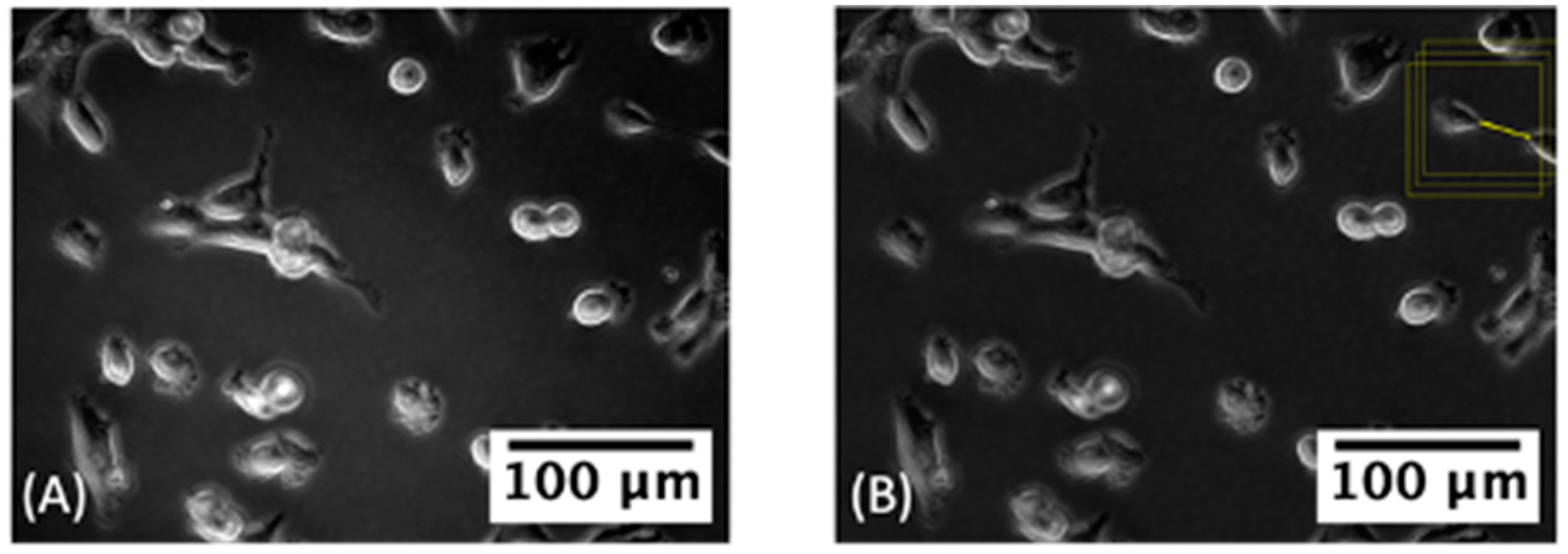 Cancers 14 04958 g004 Cancers 14 04958 g004