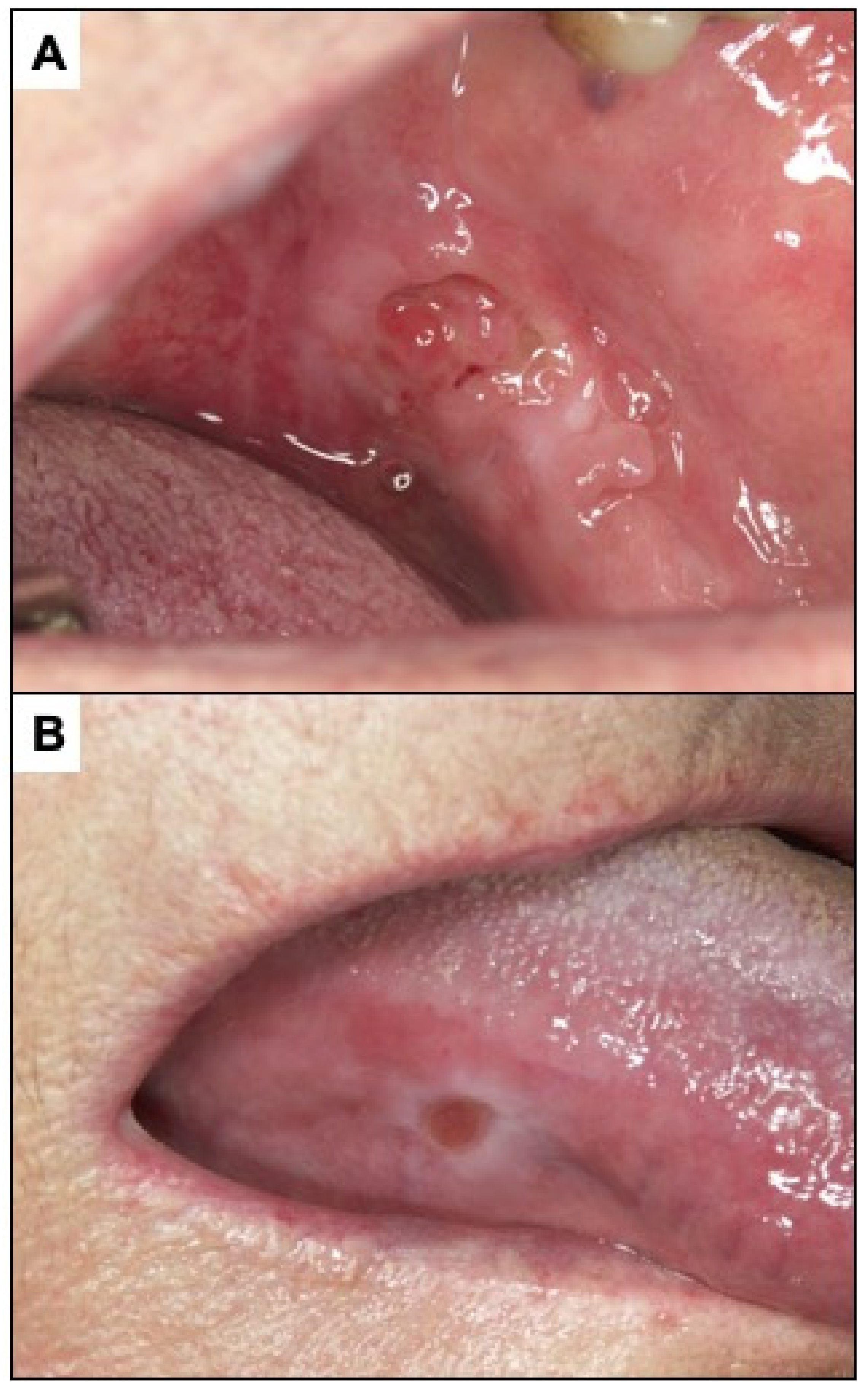 Cancers 14 04967 g006 Cancers 14 04967 g006