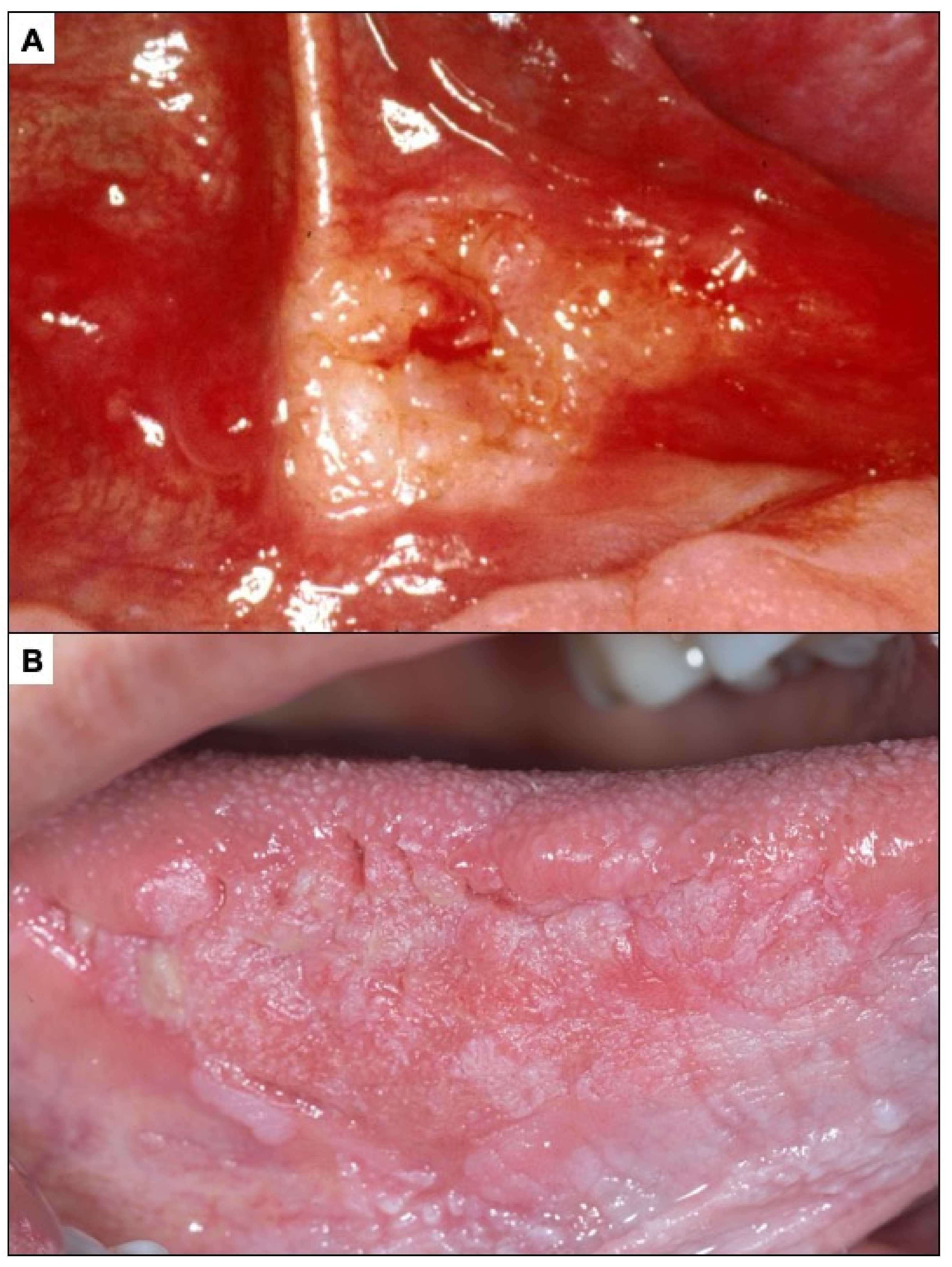 Cancers 14 04967 g007 Cancers 14 04967 g007