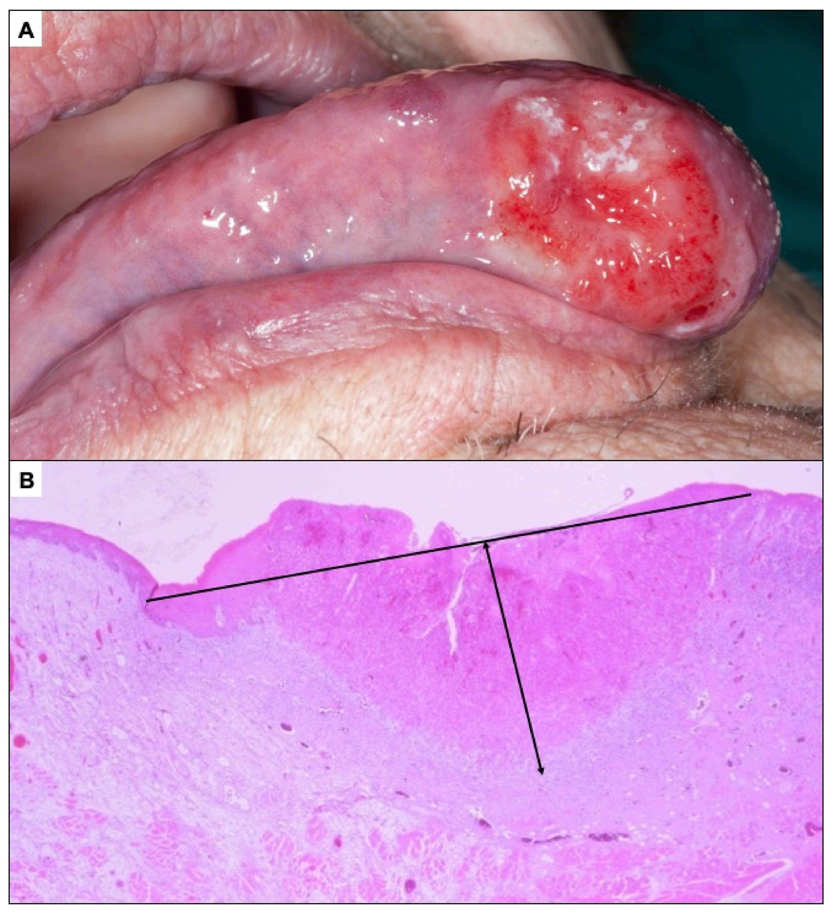 Cancers 14 04967 g008 Cancers 14 04967 g008