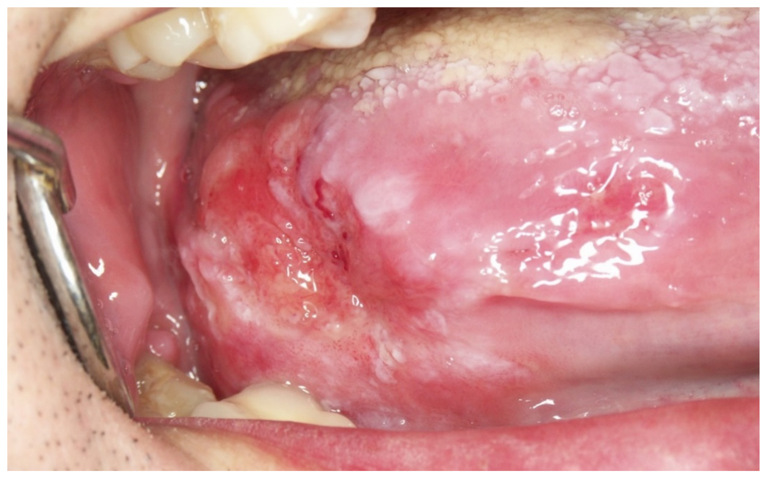 Cancers 14 04967 g009 Cancers 14 04967 g009