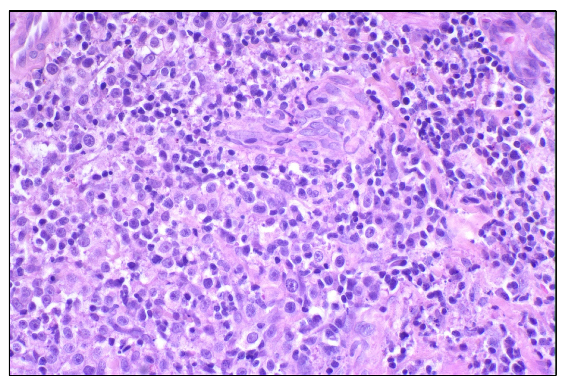 Cancers 14 05008 g002 Cancers 14 05008 g002