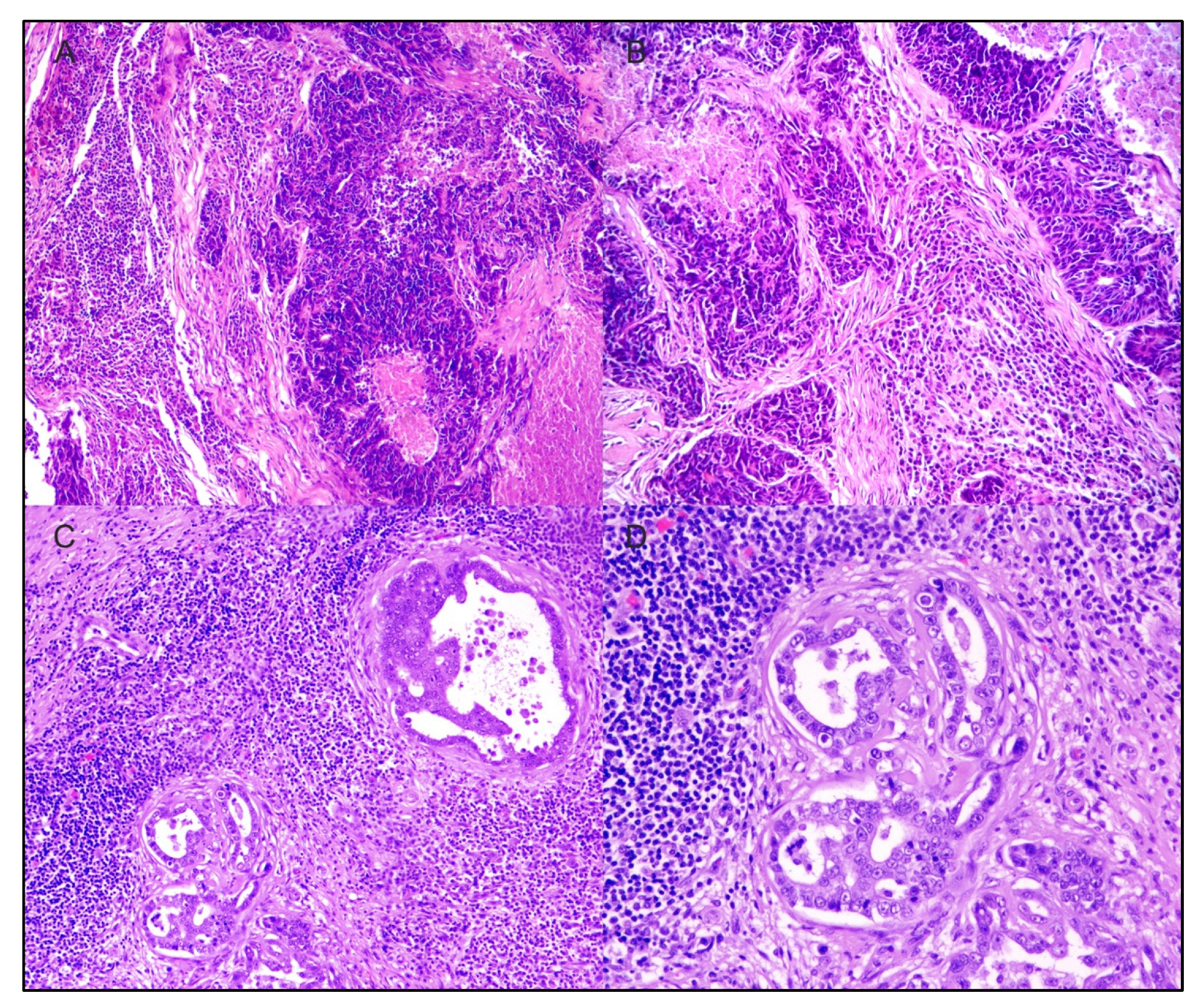 Cancers 14 05008 g003 Cancers 14 05008 g003