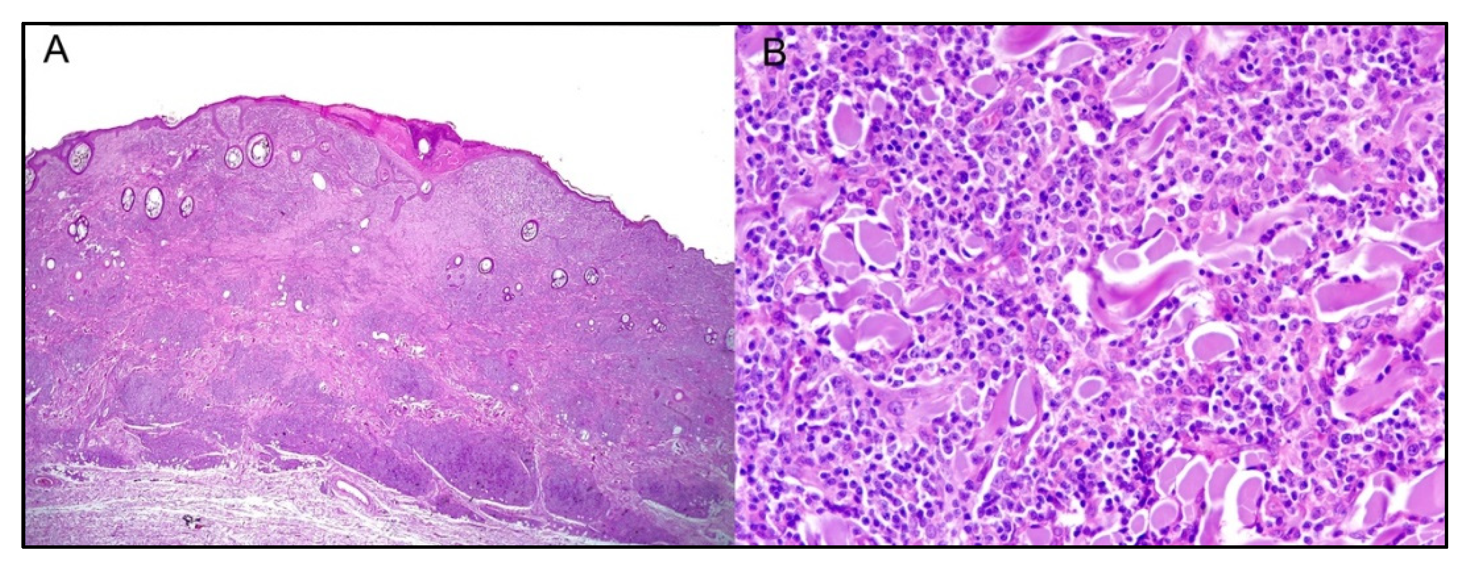 Cancers 14 05008 g005 Cancers 14 05008 g005