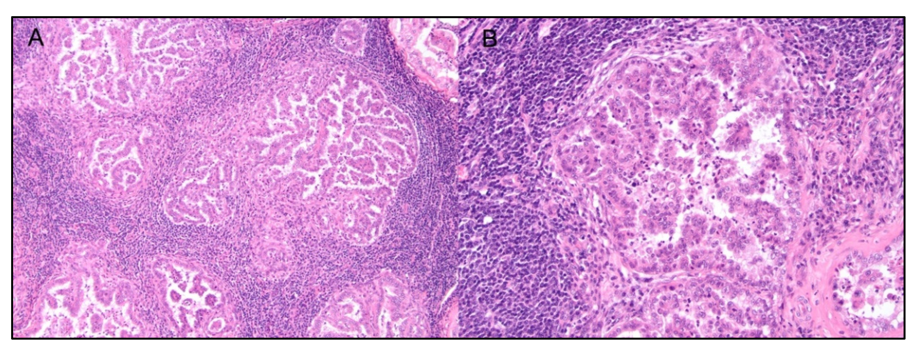 Cancers 14 05008 g007 Cancers 14 05008 g007