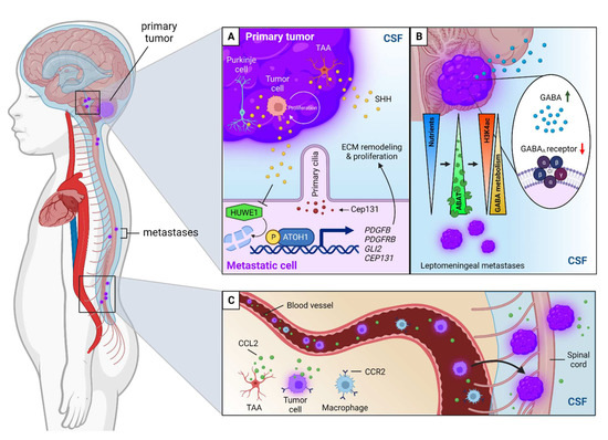 The Tumor Microenvironment of Medulloblastoma: An Intricate ...