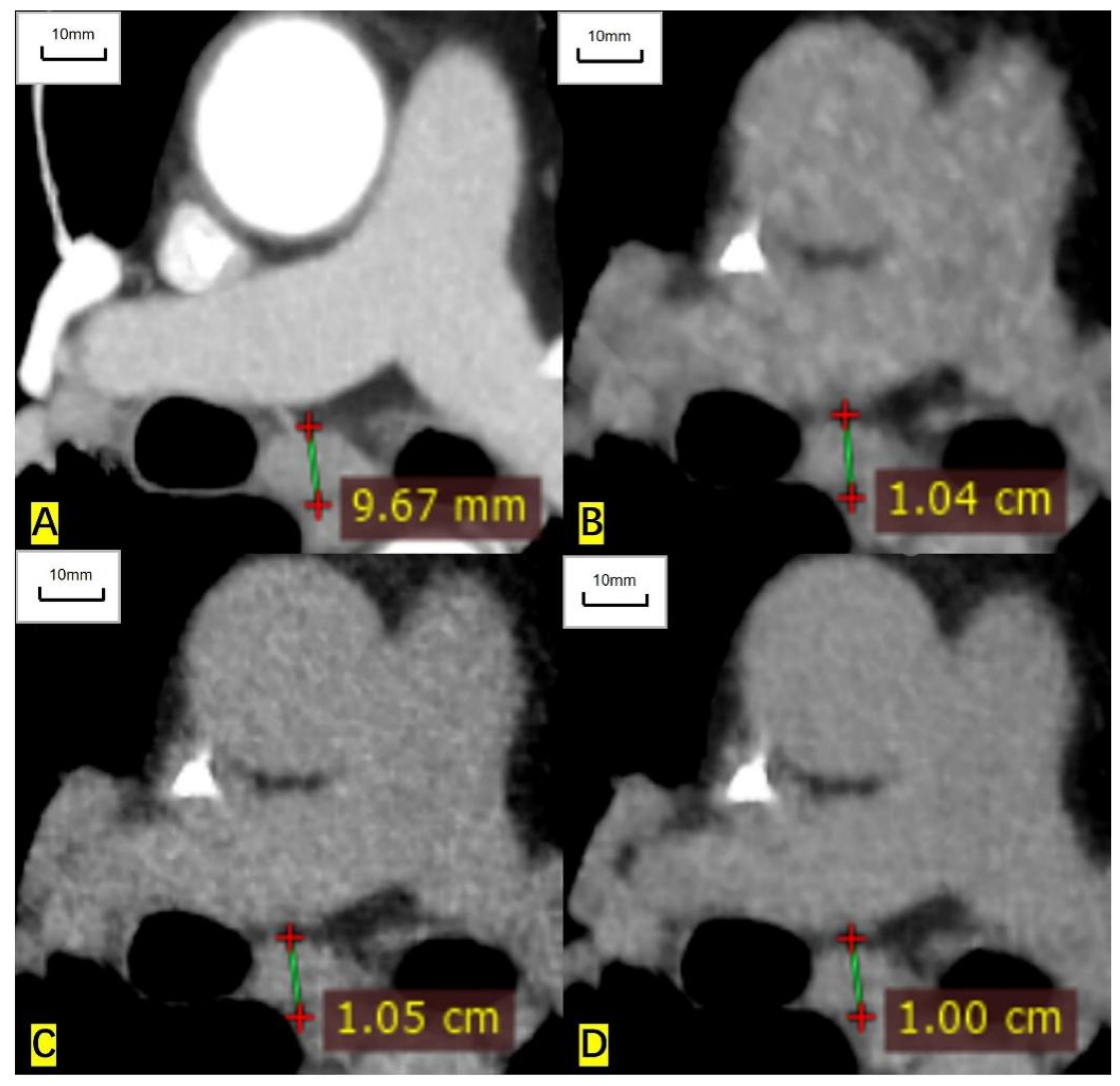 Cancers 14 05016 g005 Cancers 14 05016 g005