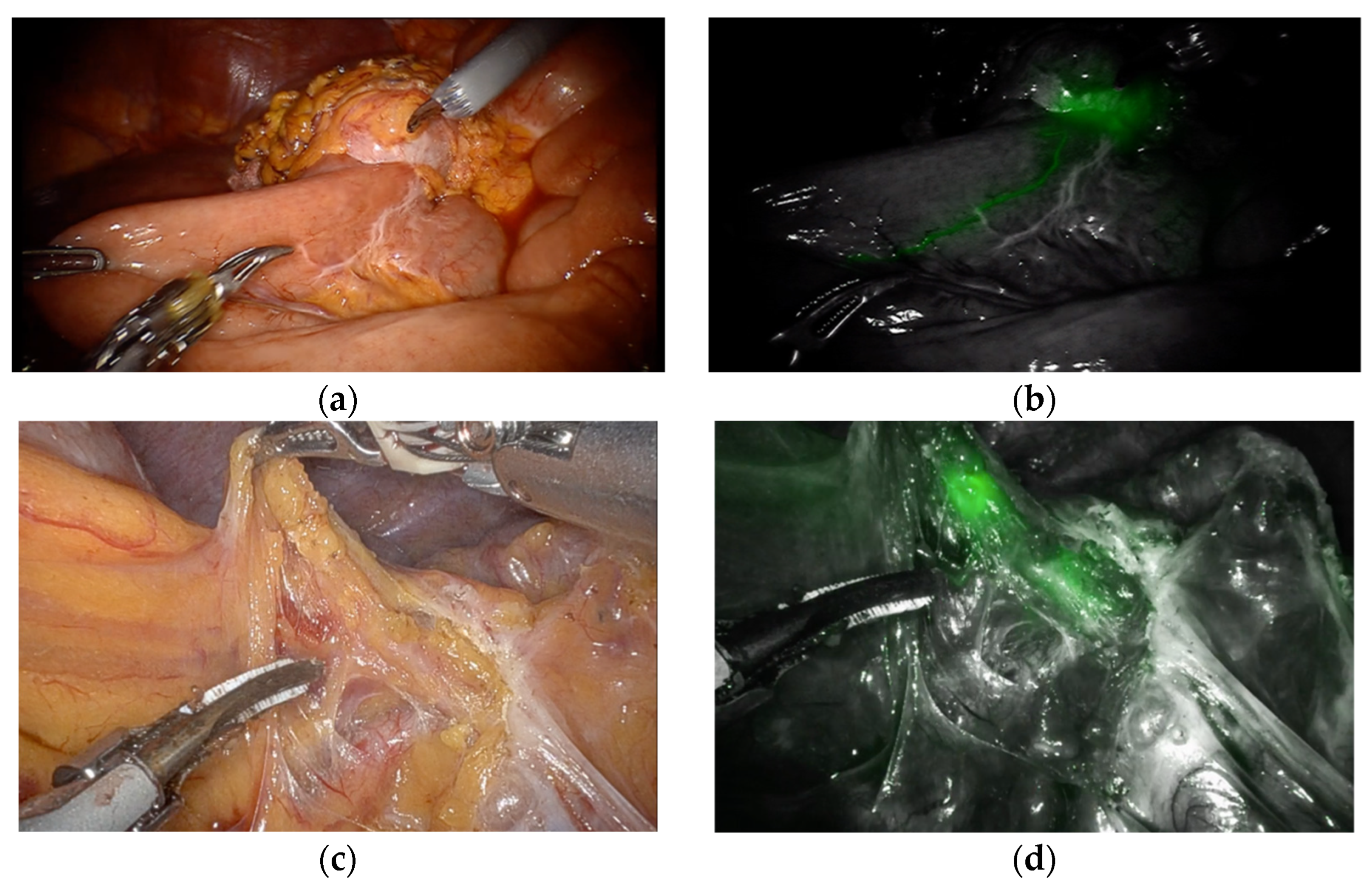 Cancers 14 05037 g001 Cancers 14 05037 g001