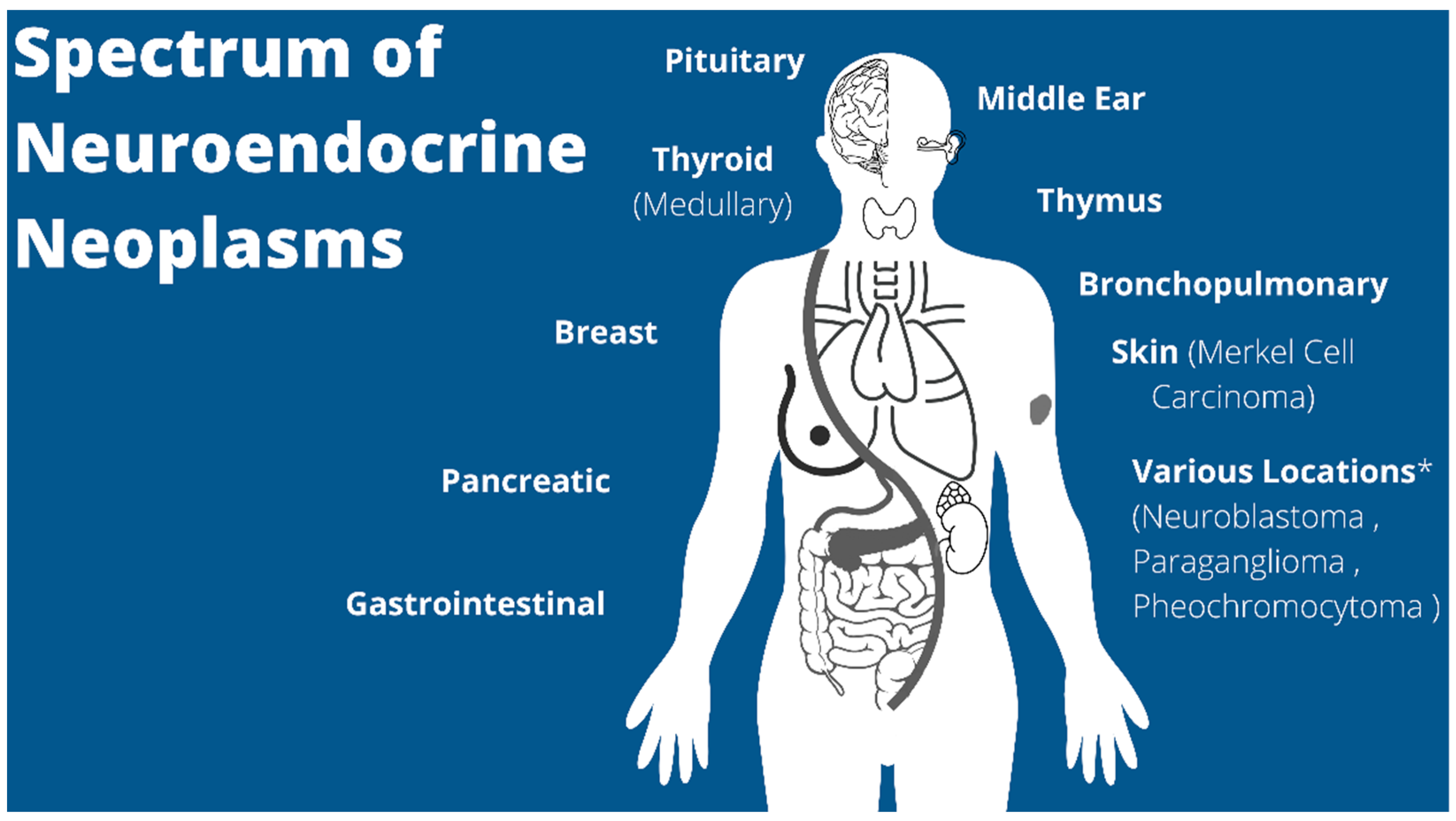 Cancers | Free Full-Text | Pediatric Neuroendocrine Neoplasms: Rare  Malignancies with Incredible Variability
