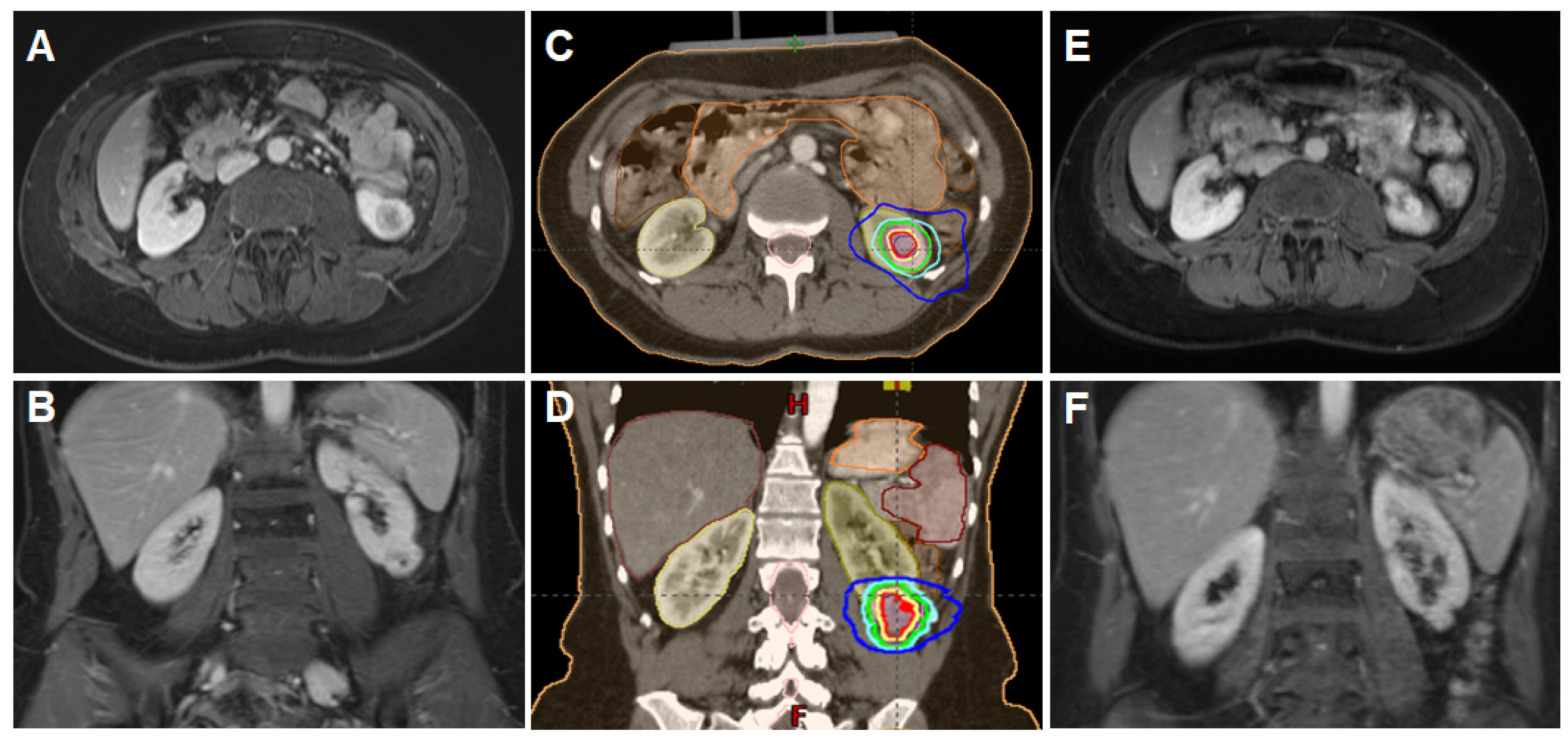 Cancers 14 05069 g001 Cancers 14 05069 g001