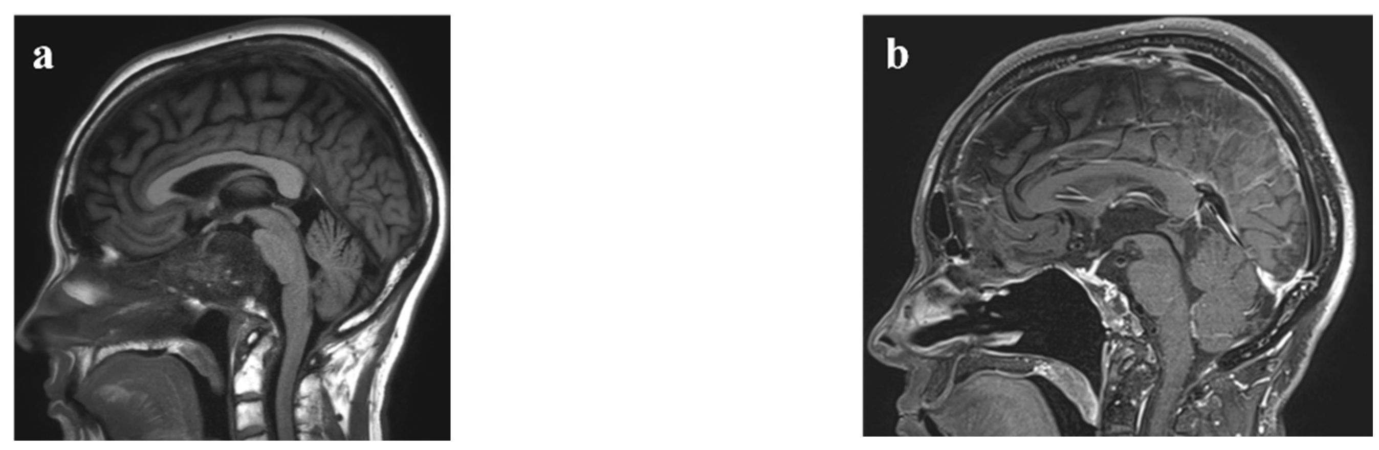 Cancers 14 05104 g003a