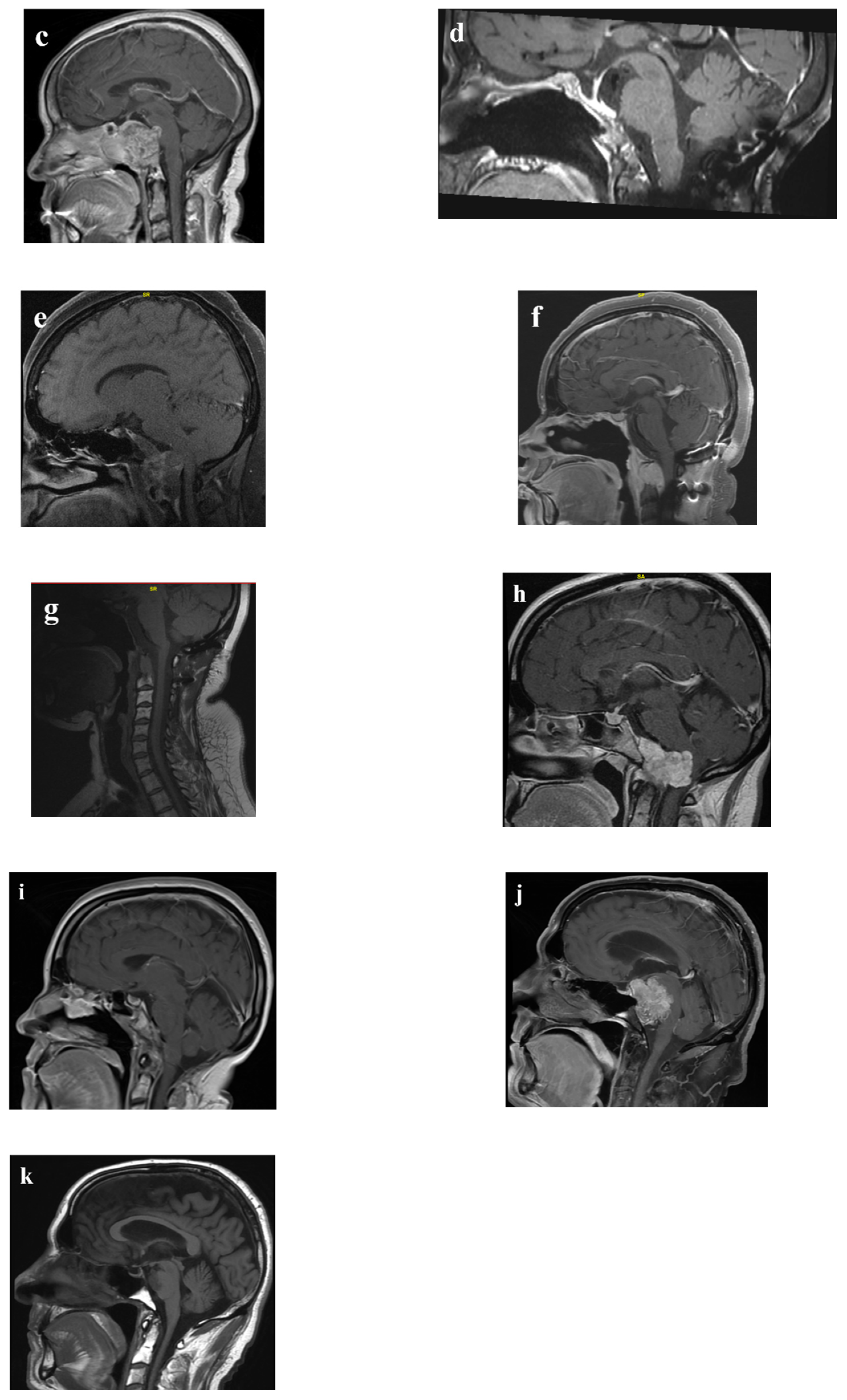 Cancers 14 05104 g003b