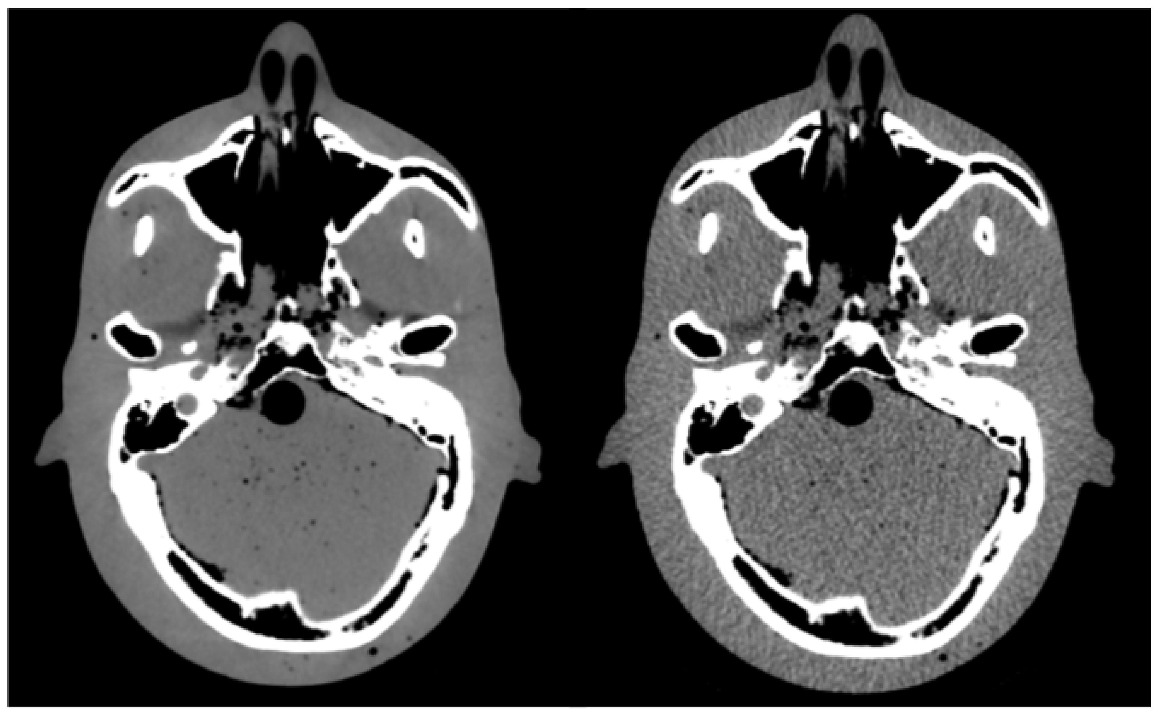 Cancers 14 05155 g002 Cancers 14 05155 g002