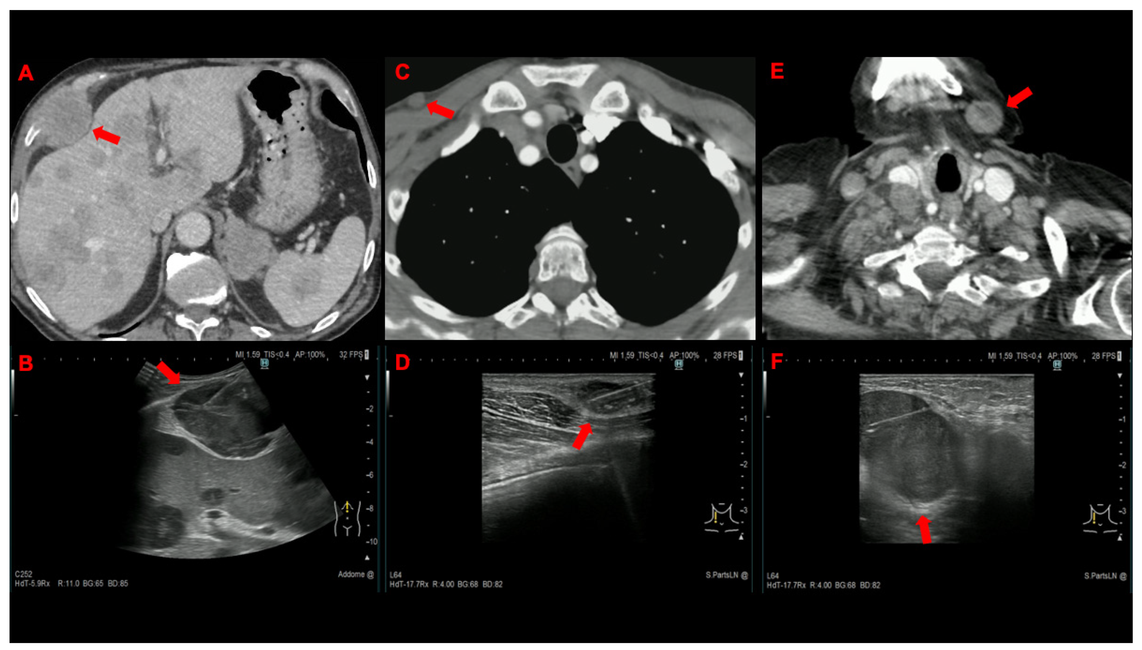 Cancers 14 05156 g002