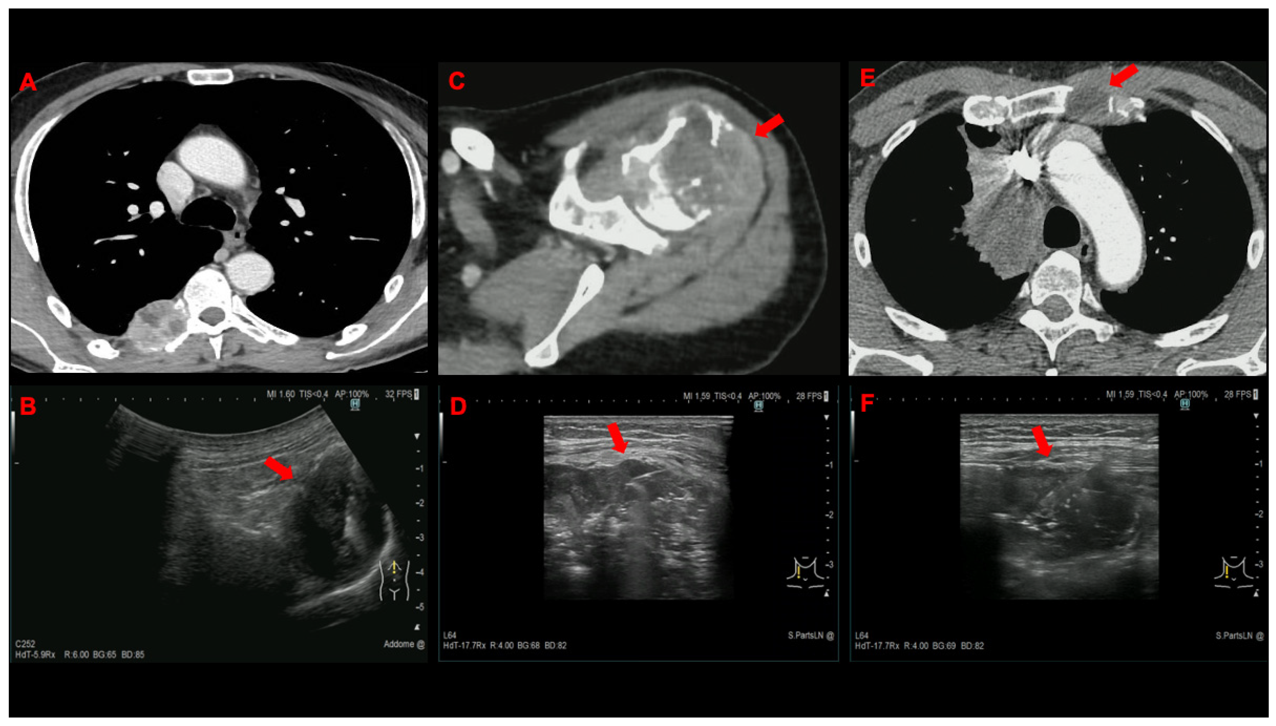 Cancers 14 05156 g003