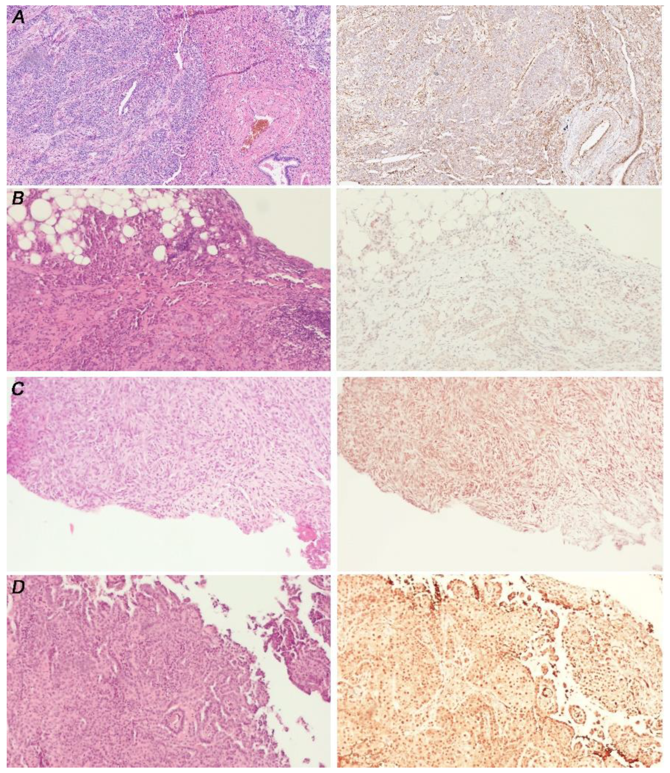 Cancers 14 05216 g005 Cancers 14 05216 g005