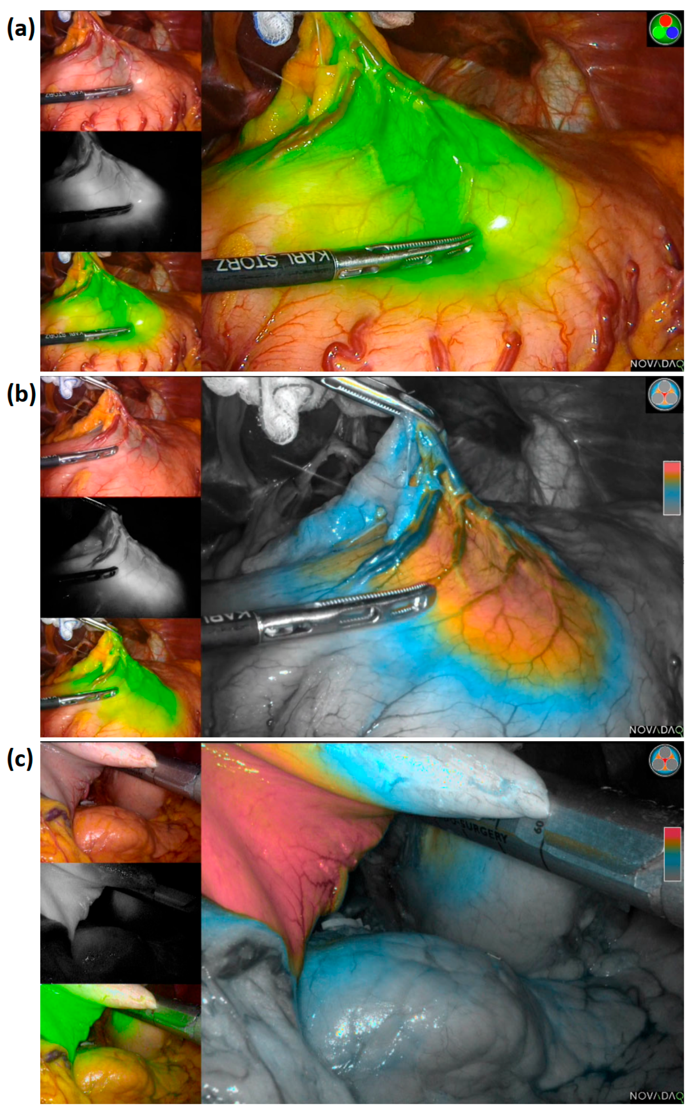 Cancers 14 05223 g002 Cancers 14 05223 g002