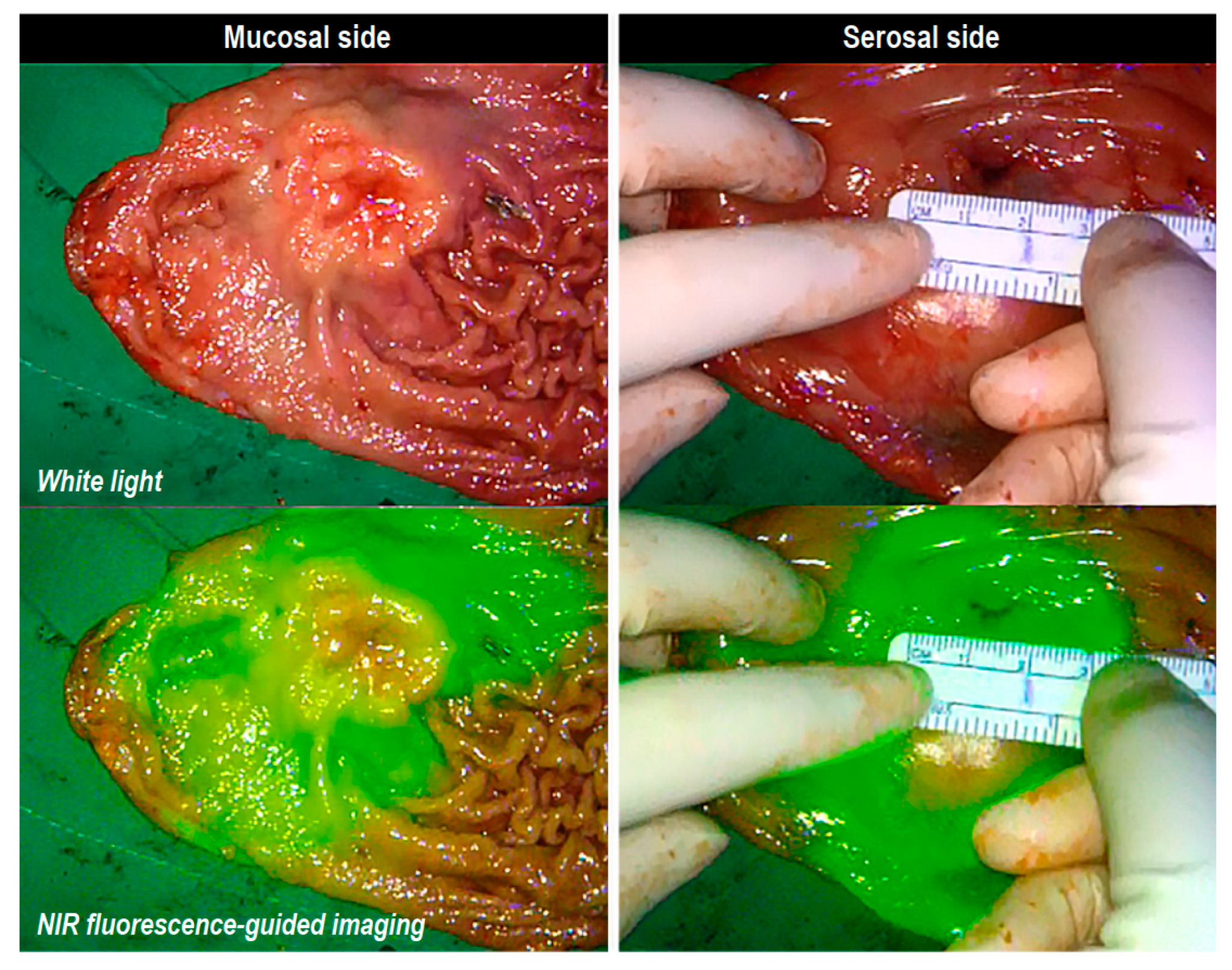 Cancers 14 05223 g003 Cancers 14 05223 g003