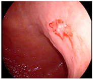 Cancers 14 05223 i001 Cancers 14 05223 i001