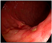 Cancers 14 05223 i002 Cancers 14 05223 i002