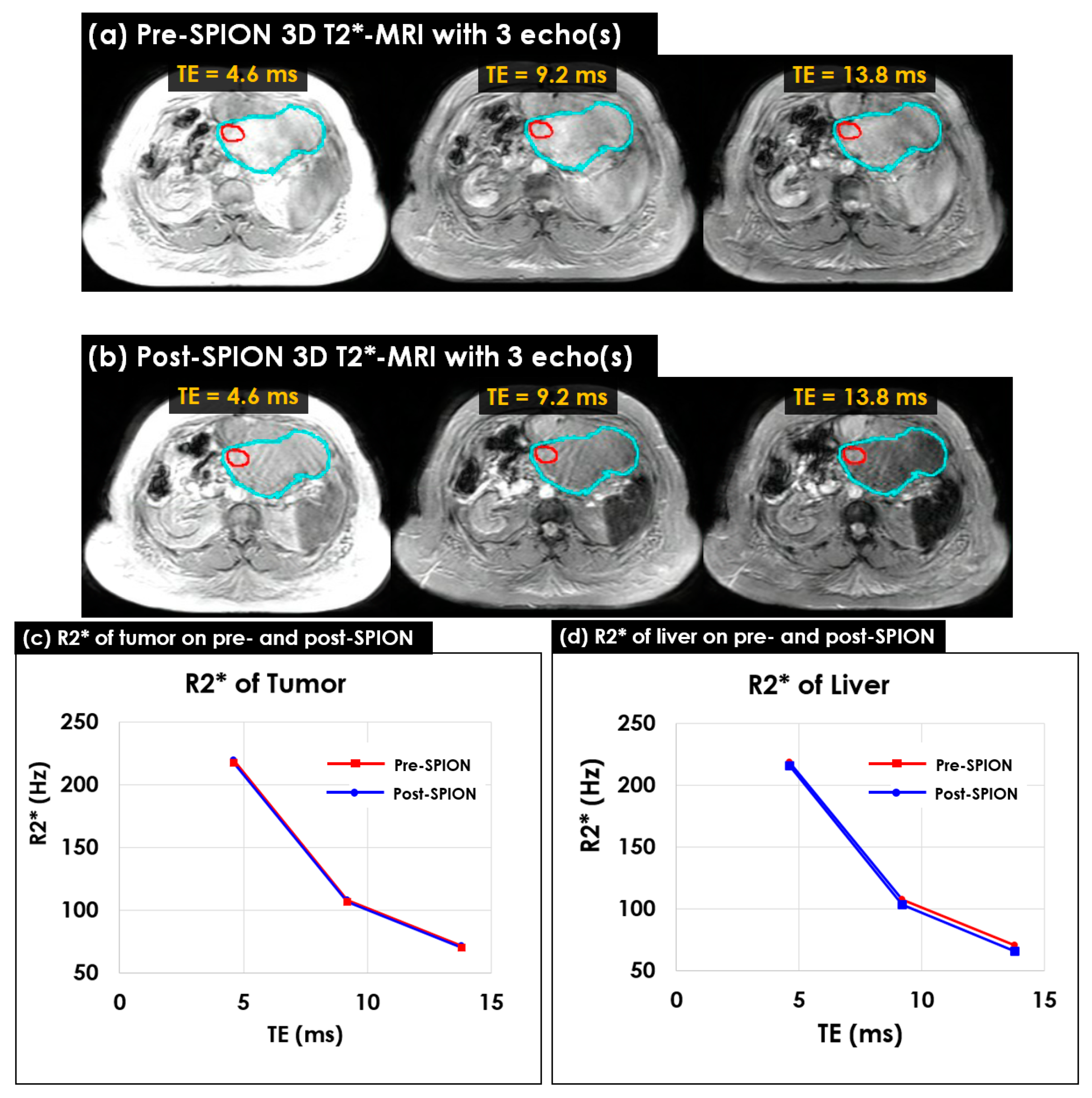 Cancers 14 05269 g004 Cancers 14 05269 g004