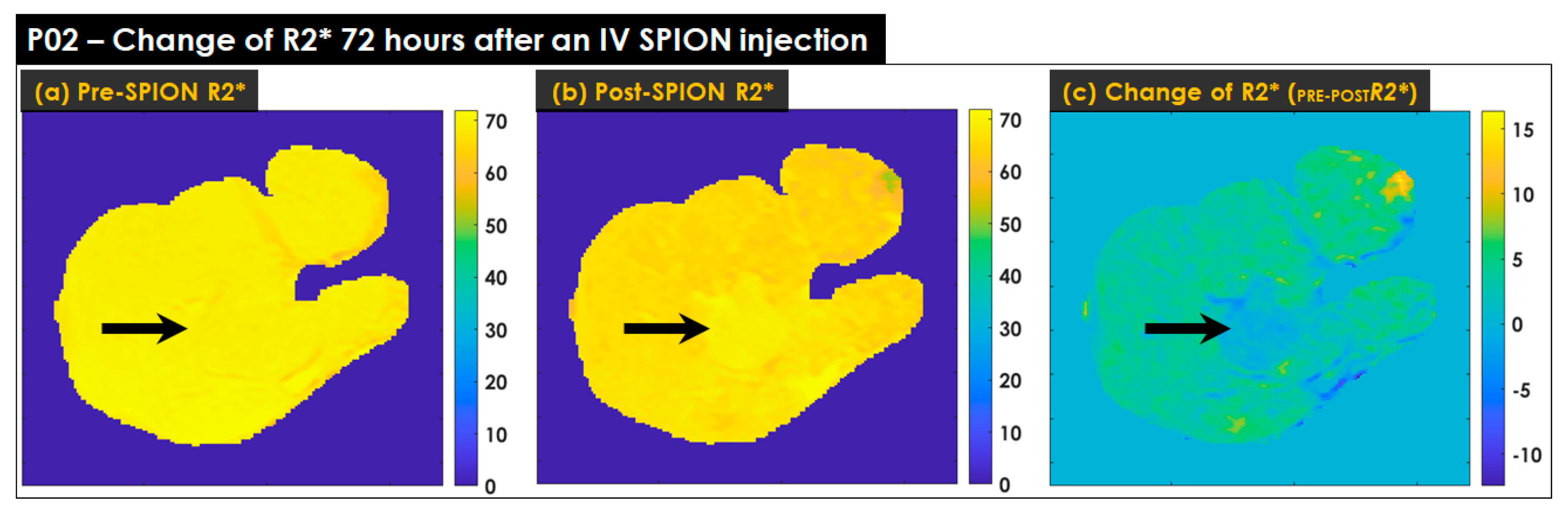Cancers 14 05269 g005 Cancers 14 05269 g005