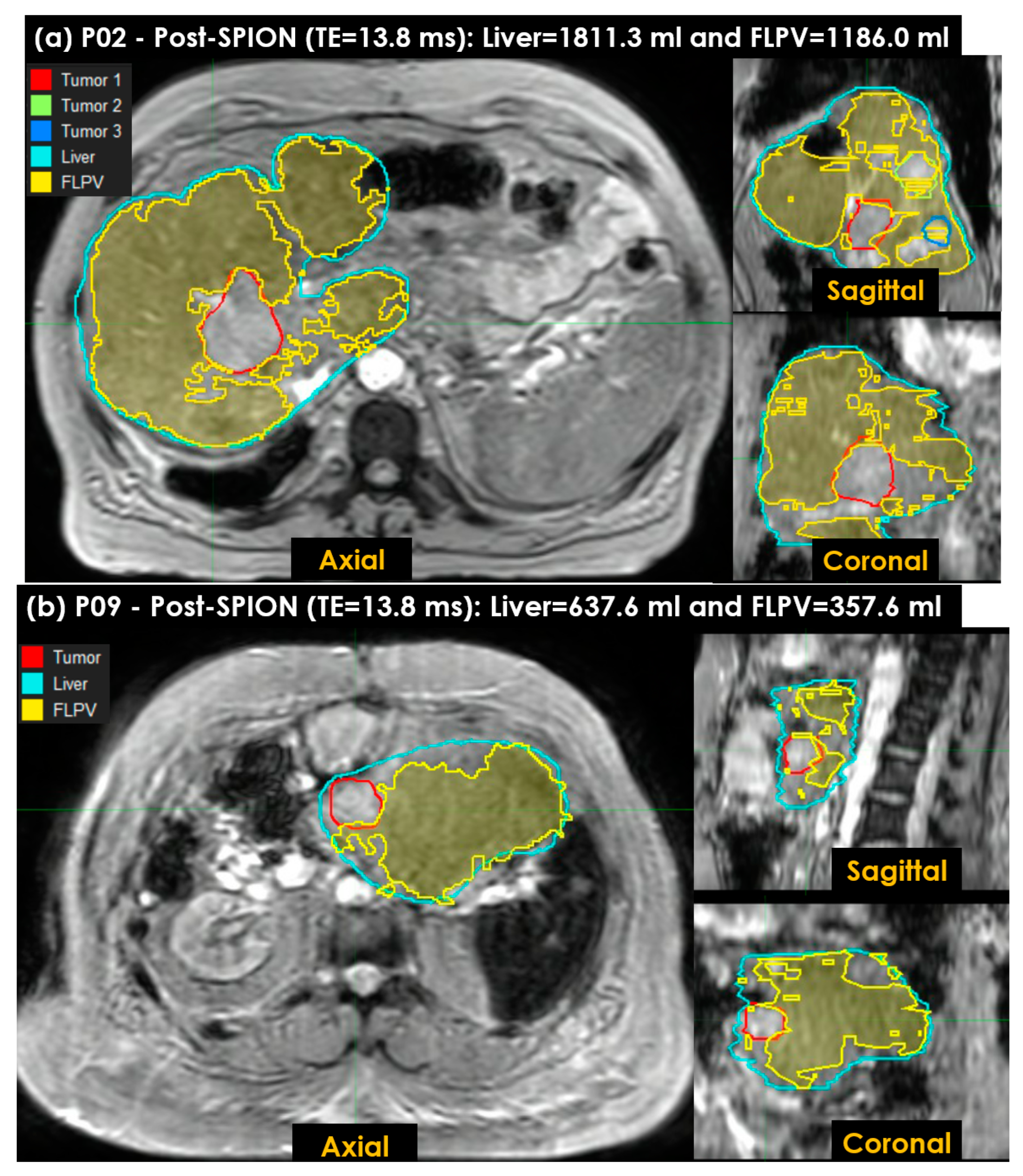 Cancers 14 05269 g007 Cancers 14 05269 g007