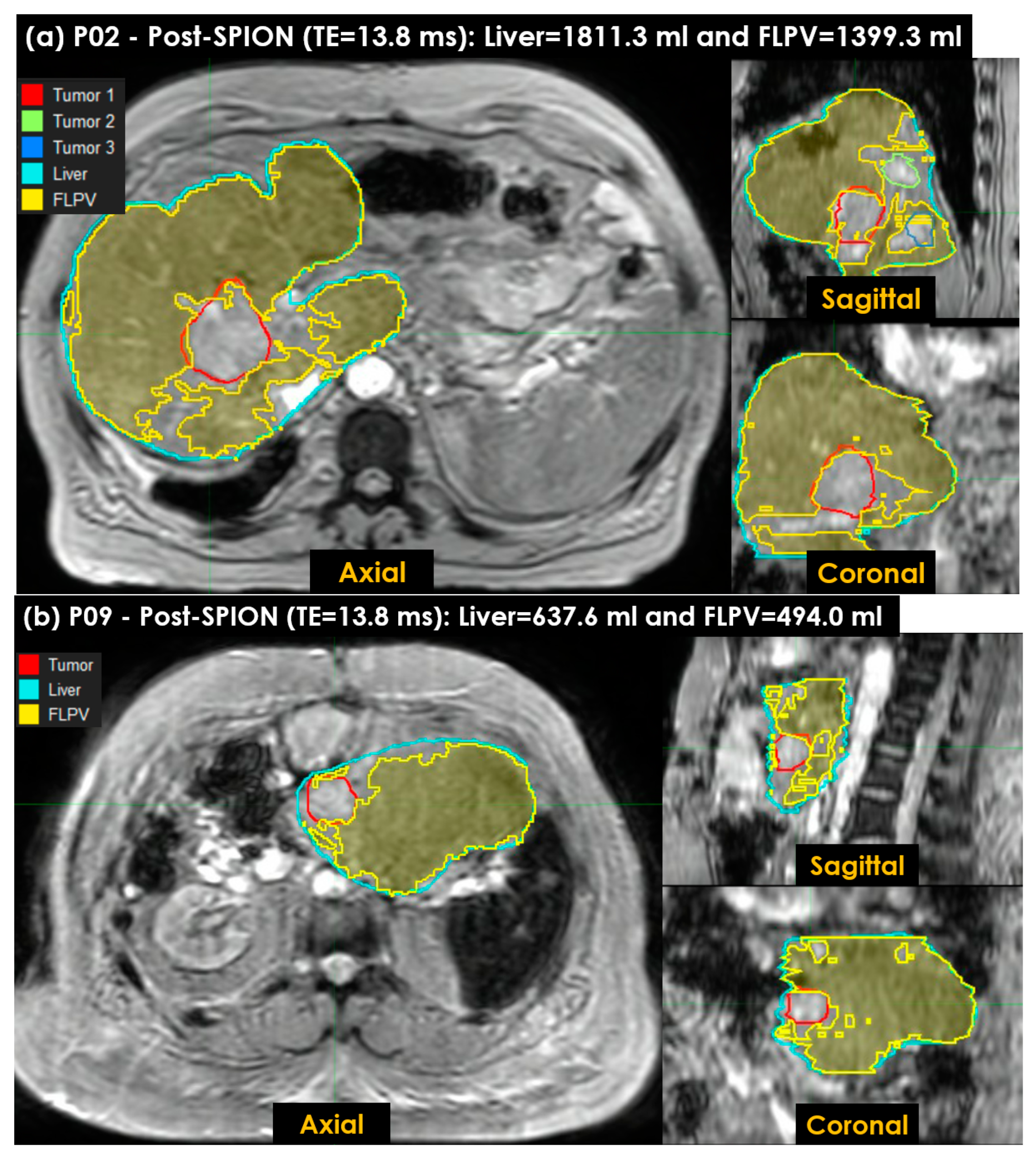 Cancers 14 05269 g008 Cancers 14 05269 g008