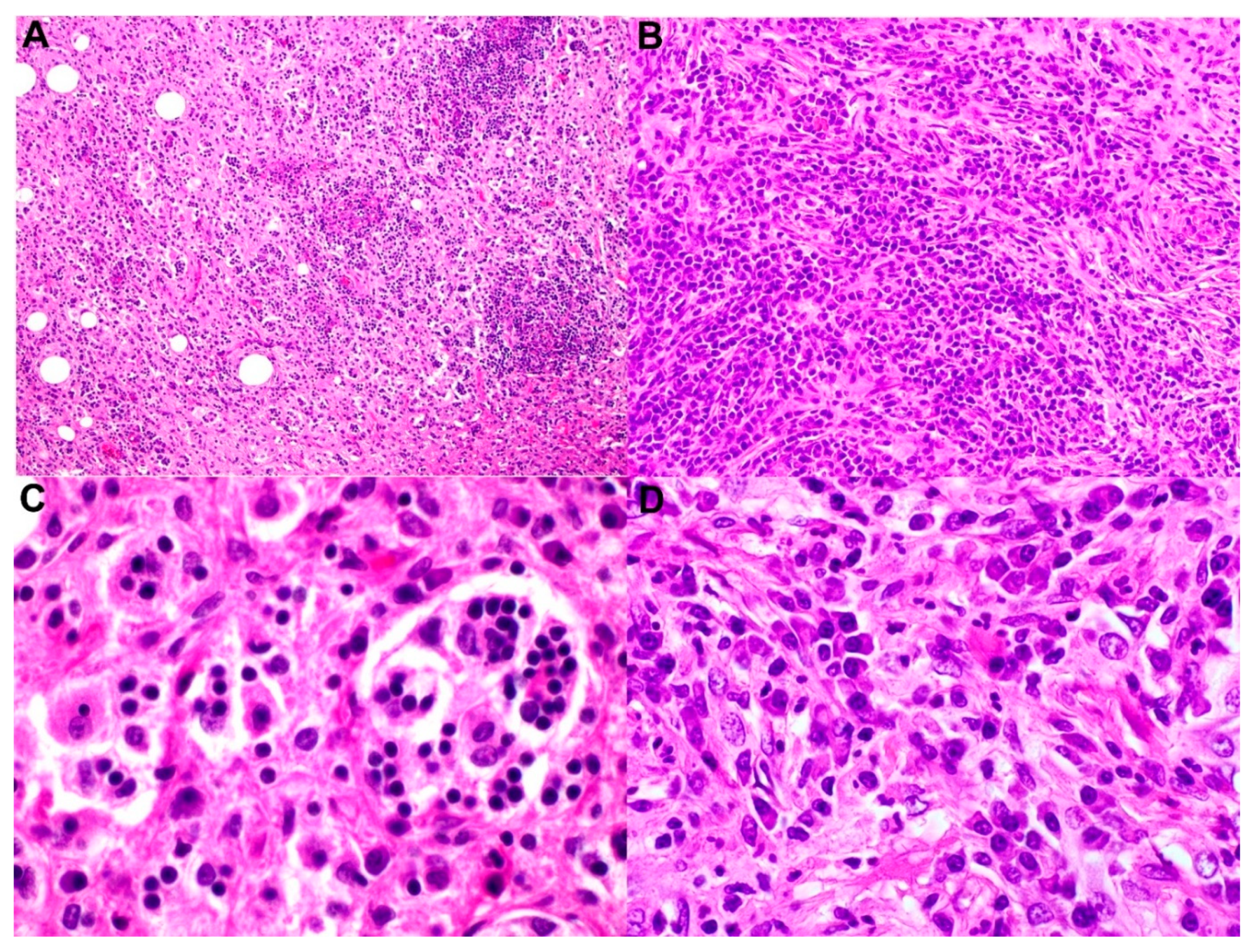 Cancers 14 05271 g001 Cancers 14 05271 g001