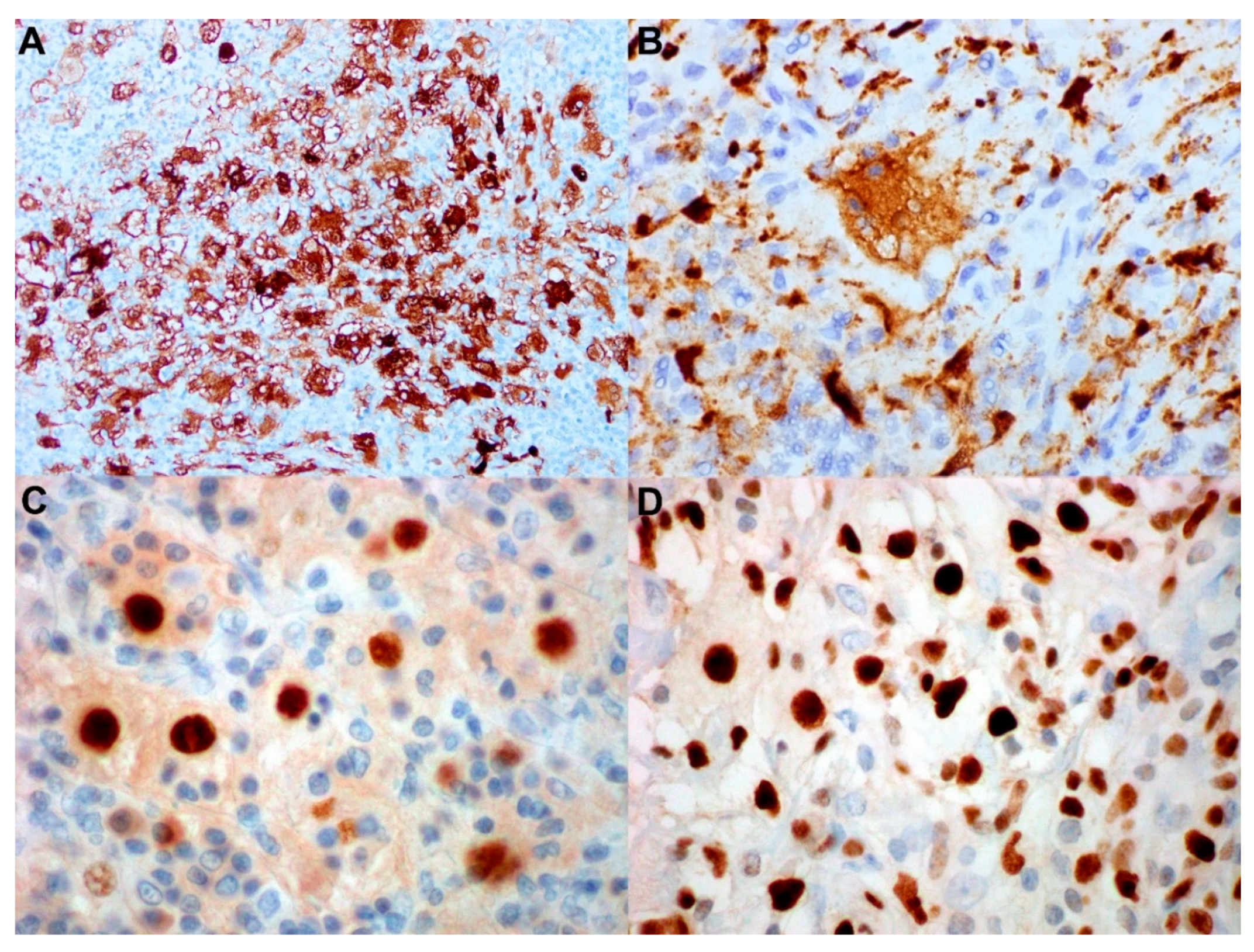 Cancers 14 05271 g002 Cancers 14 05271 g002