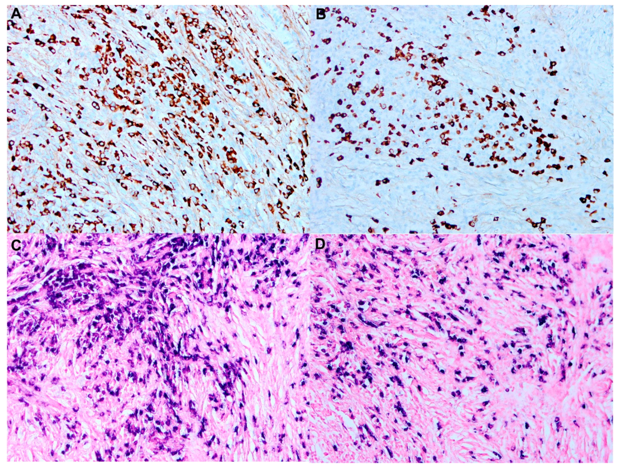 Cancers 14 05271 g003 Cancers 14 05271 g003