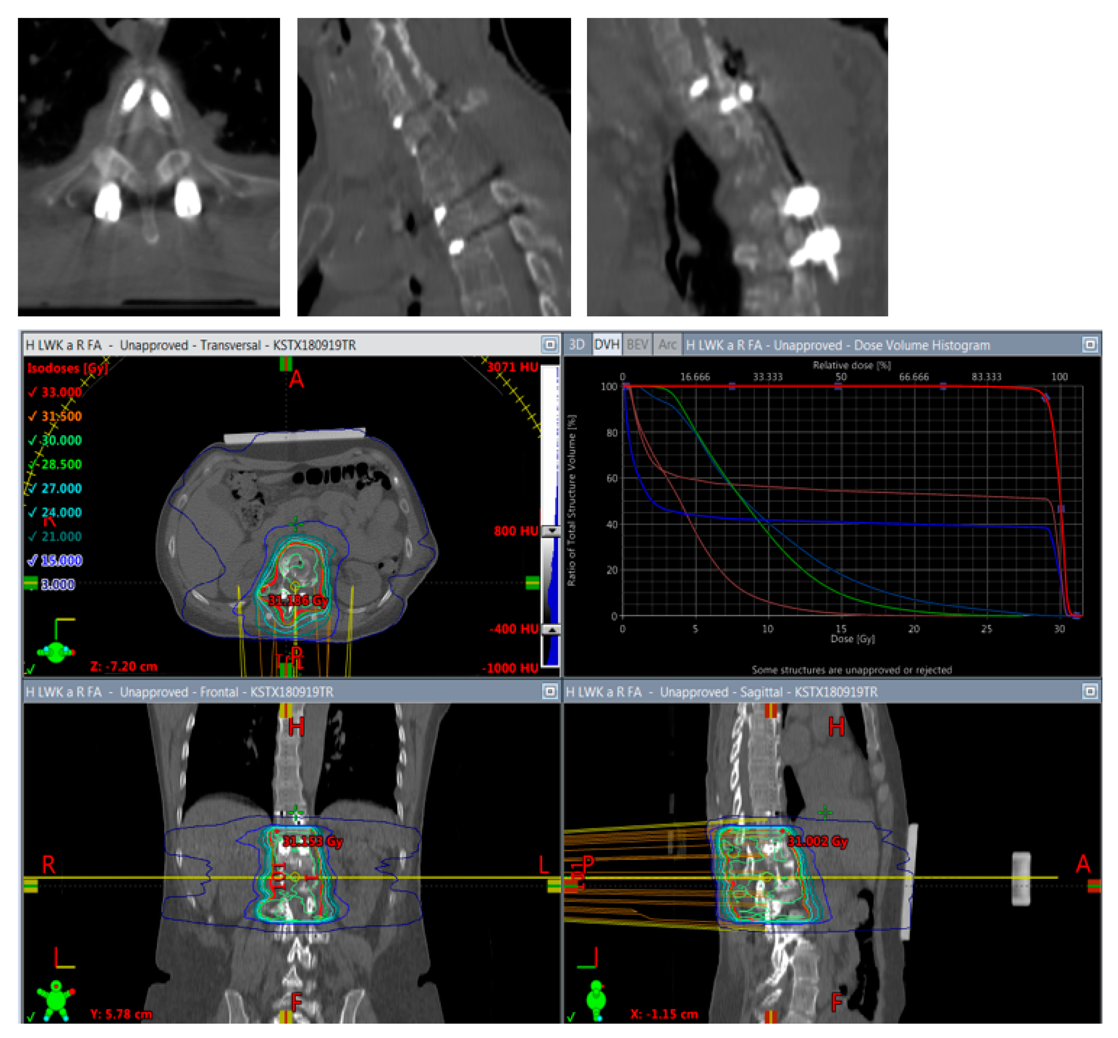 Cancers 14 05275 g005 Cancers 14 05275 g005