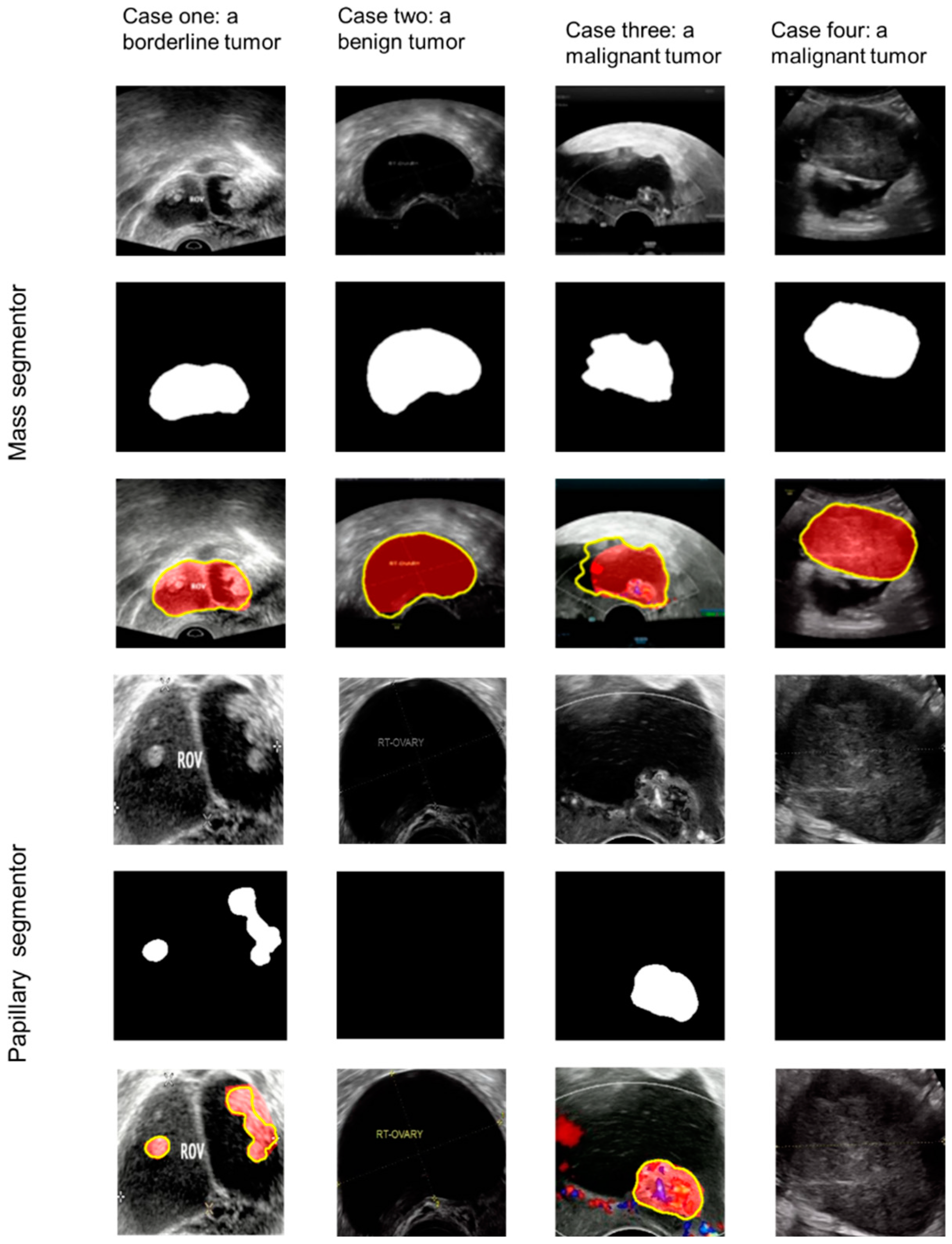 Cancers 14 05291 g003