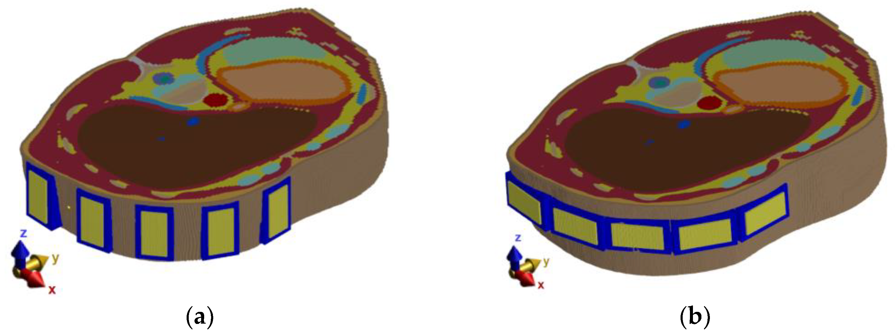 Cancers 14 05296 g004