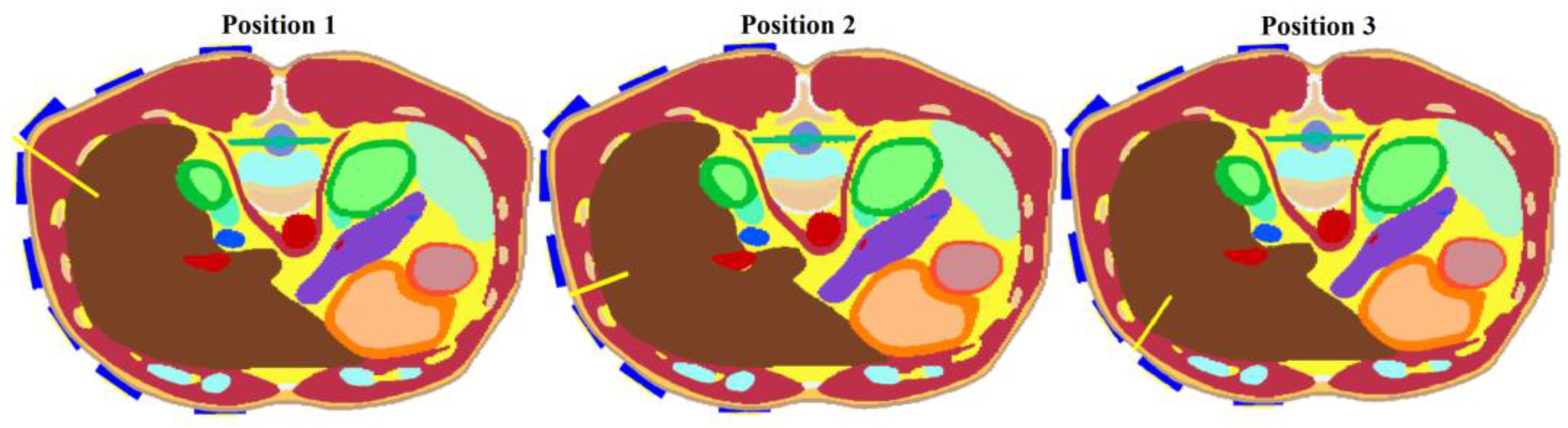 Cancers 14 05296 g005