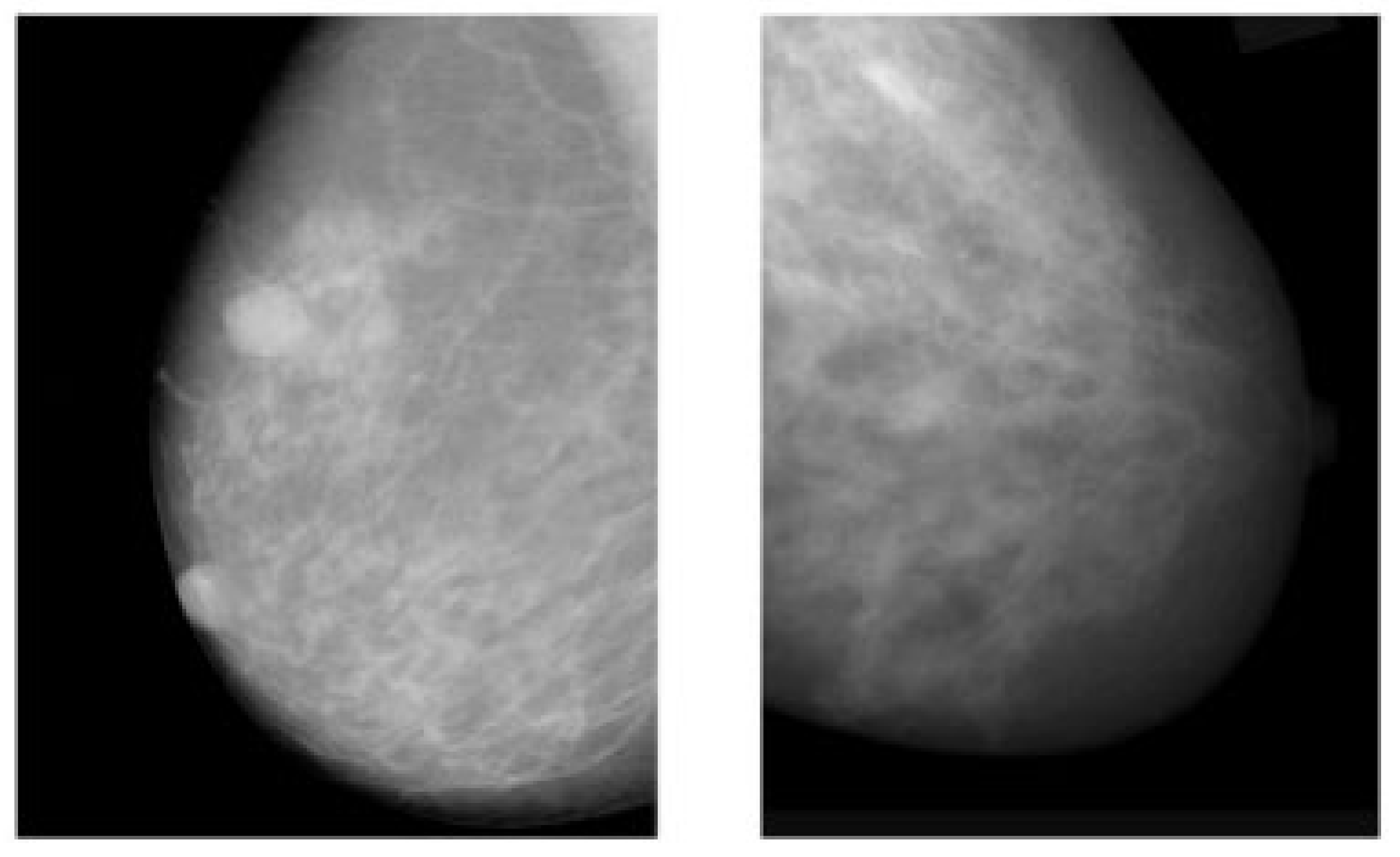 Next Ajith Hd New Hot Sex Video - Cancers | Free Full-Text | The Role of Deep Learning in Advancing Breast  Cancer Detection Using Different Imaging Modalities: A Systematic Review