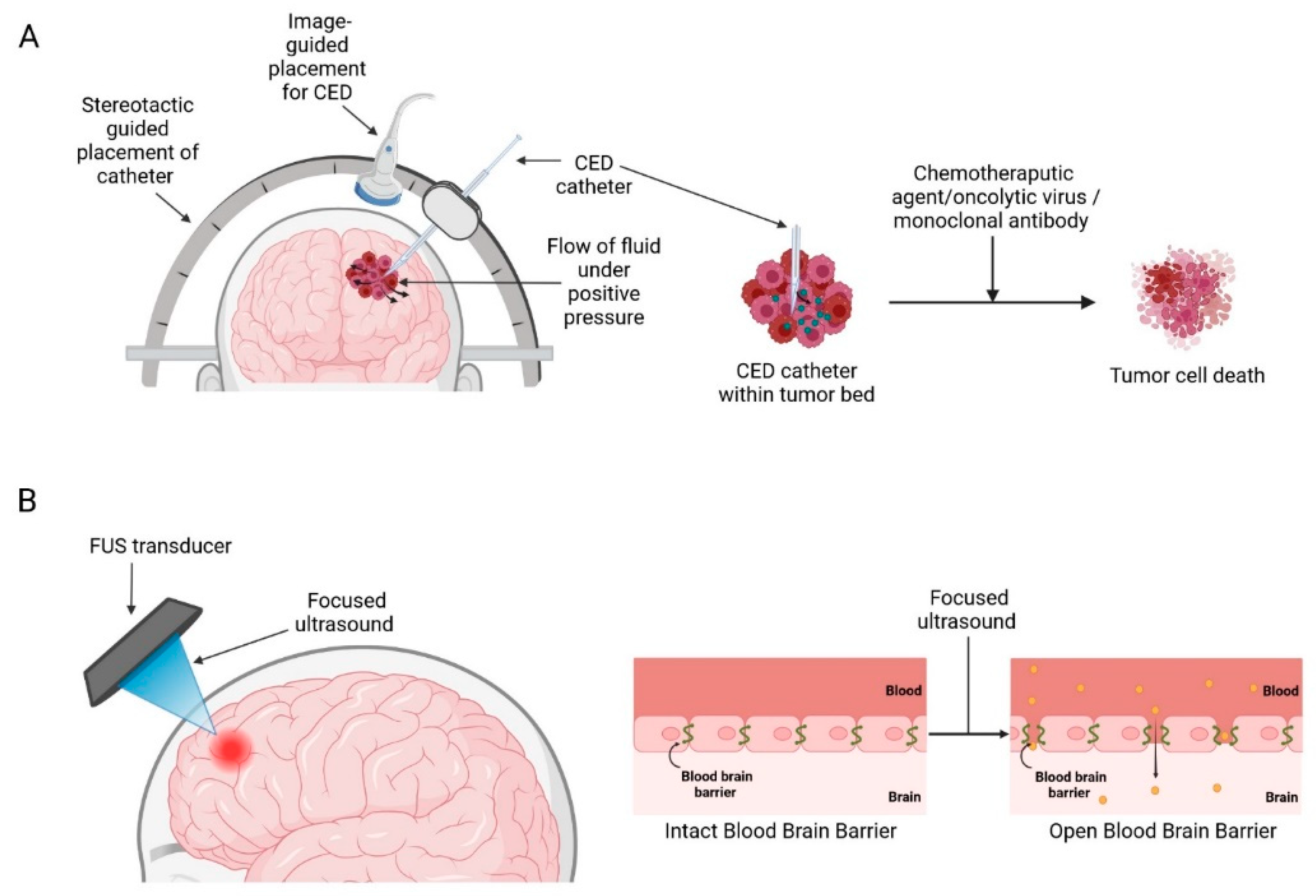 Cancers 14 05341 g003 Cancers 14 05341 g003