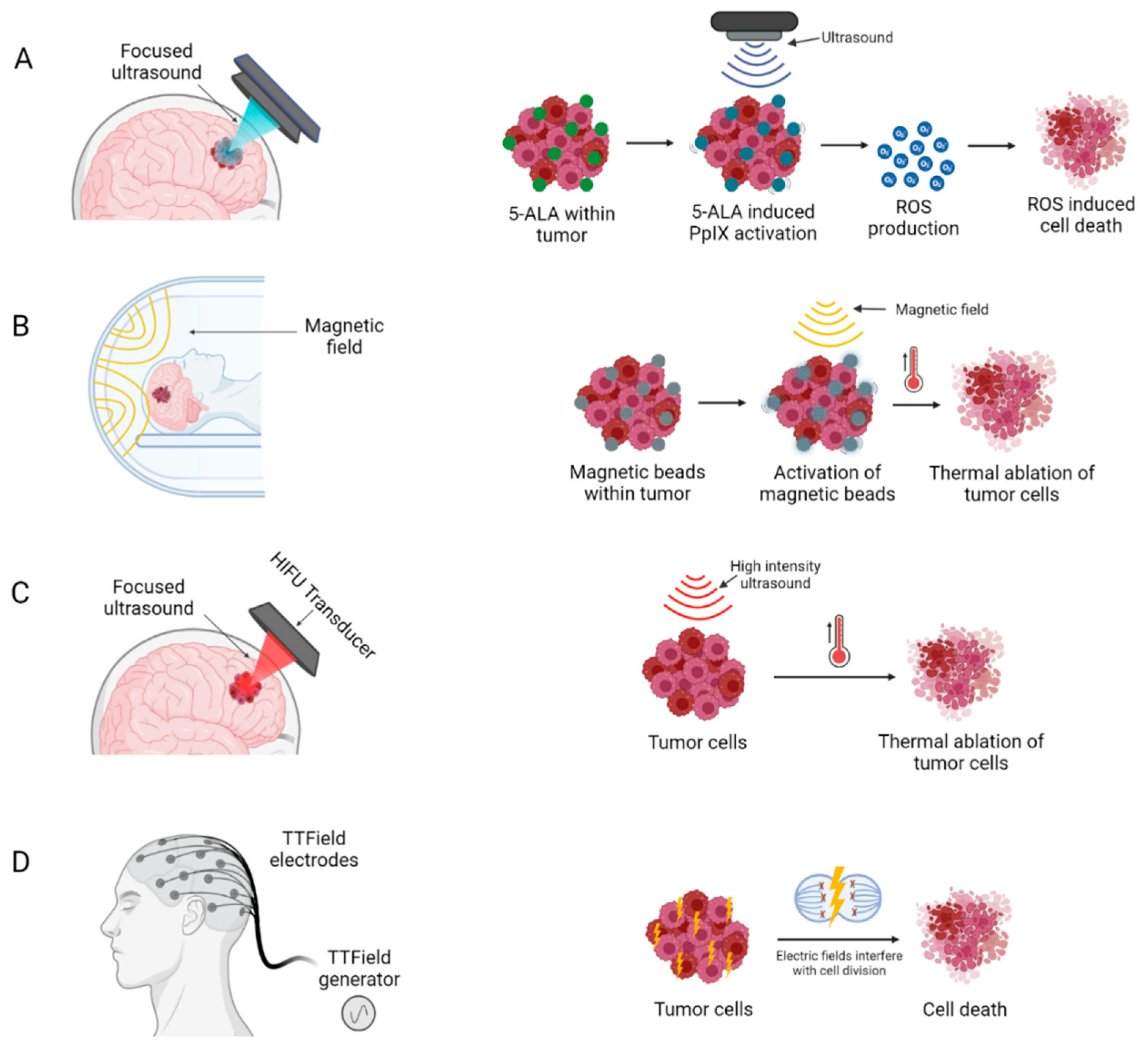 Cancers 14 05341 g004 Cancers 14 05341 g004