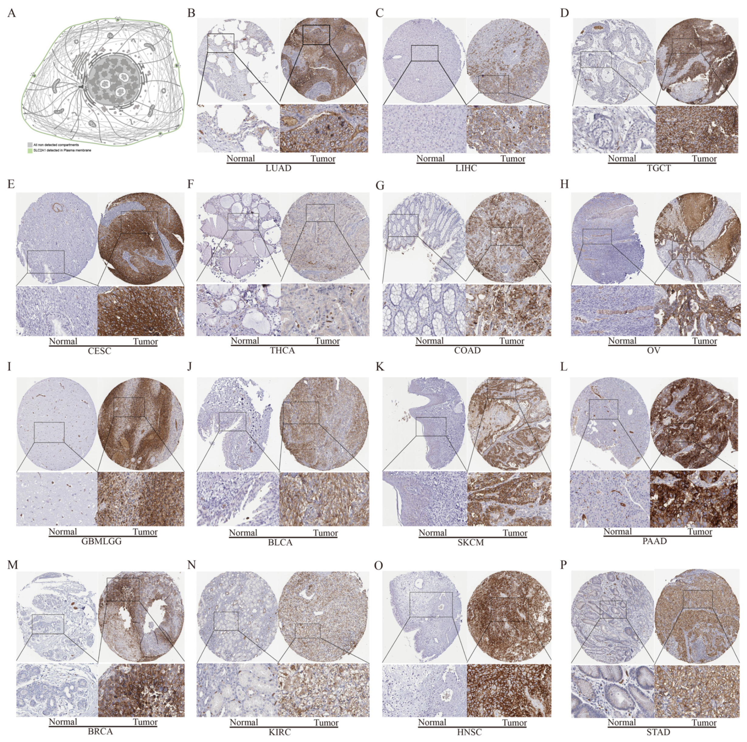 Cancers 14 05344 g004 Cancers 14 05344 g004