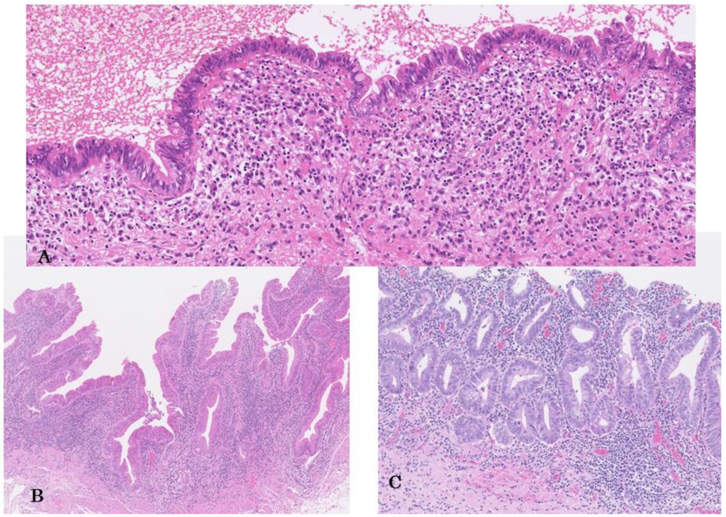 Cancers 14 05358 g001 Cancers 14 05358 g001