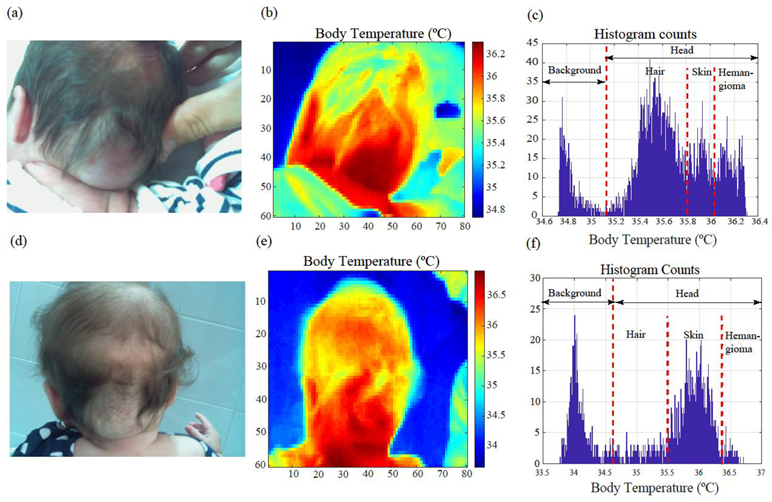 Cancers 14 05392 g004 Cancers 14 05392 g004