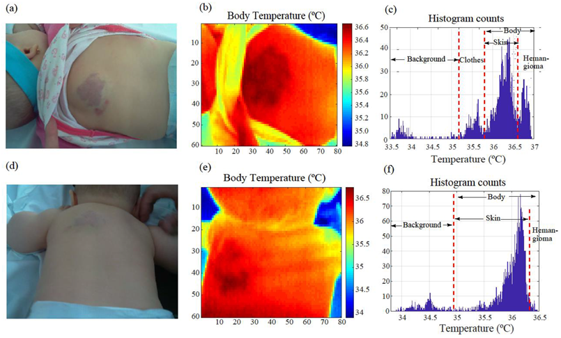 Cancers 14 05392 g005 Cancers 14 05392 g005