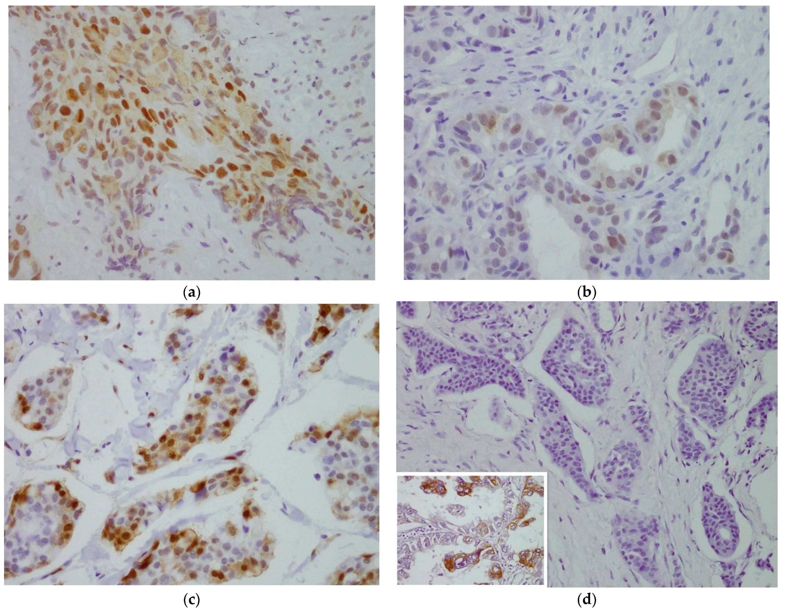 Cancers 14 05393 g001