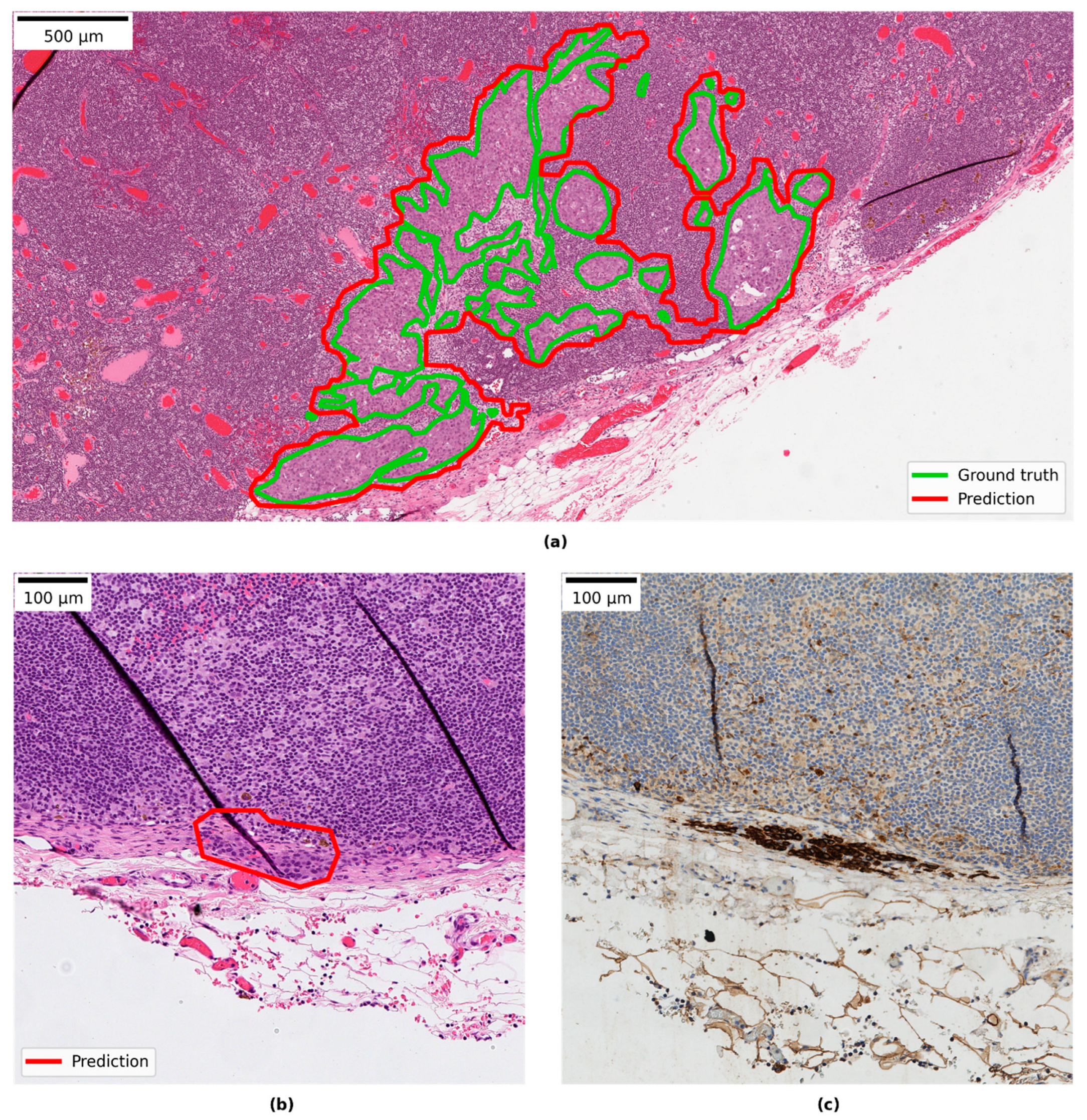 Cancers 14 05424 g004 Cancers 14 05424 g004