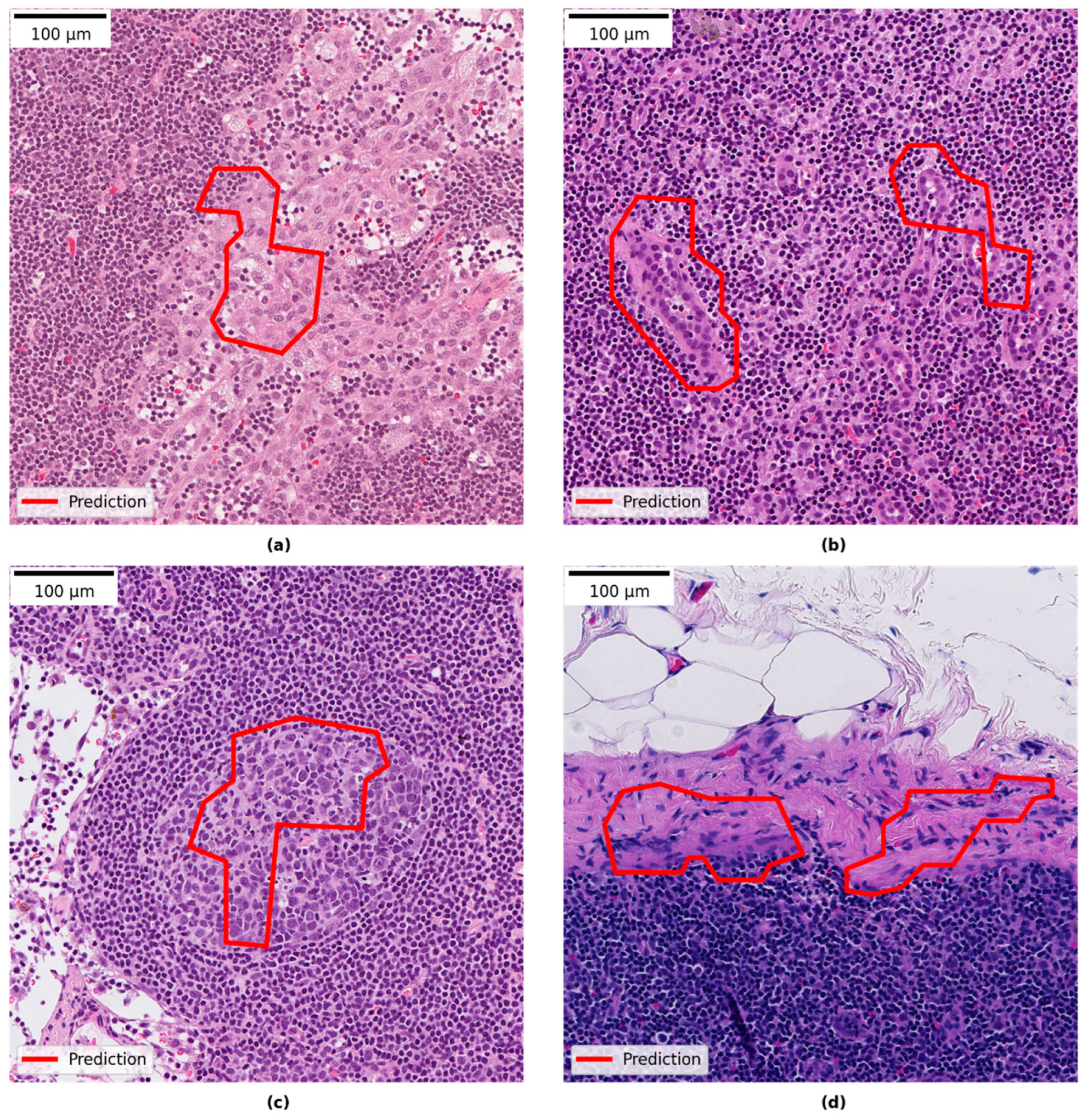 Cancers 14 05424 g005 Cancers 14 05424 g005