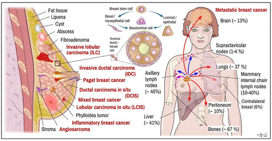健康・医学 Breast Cancer Classic and New Markers in Diagnostics and Classification of