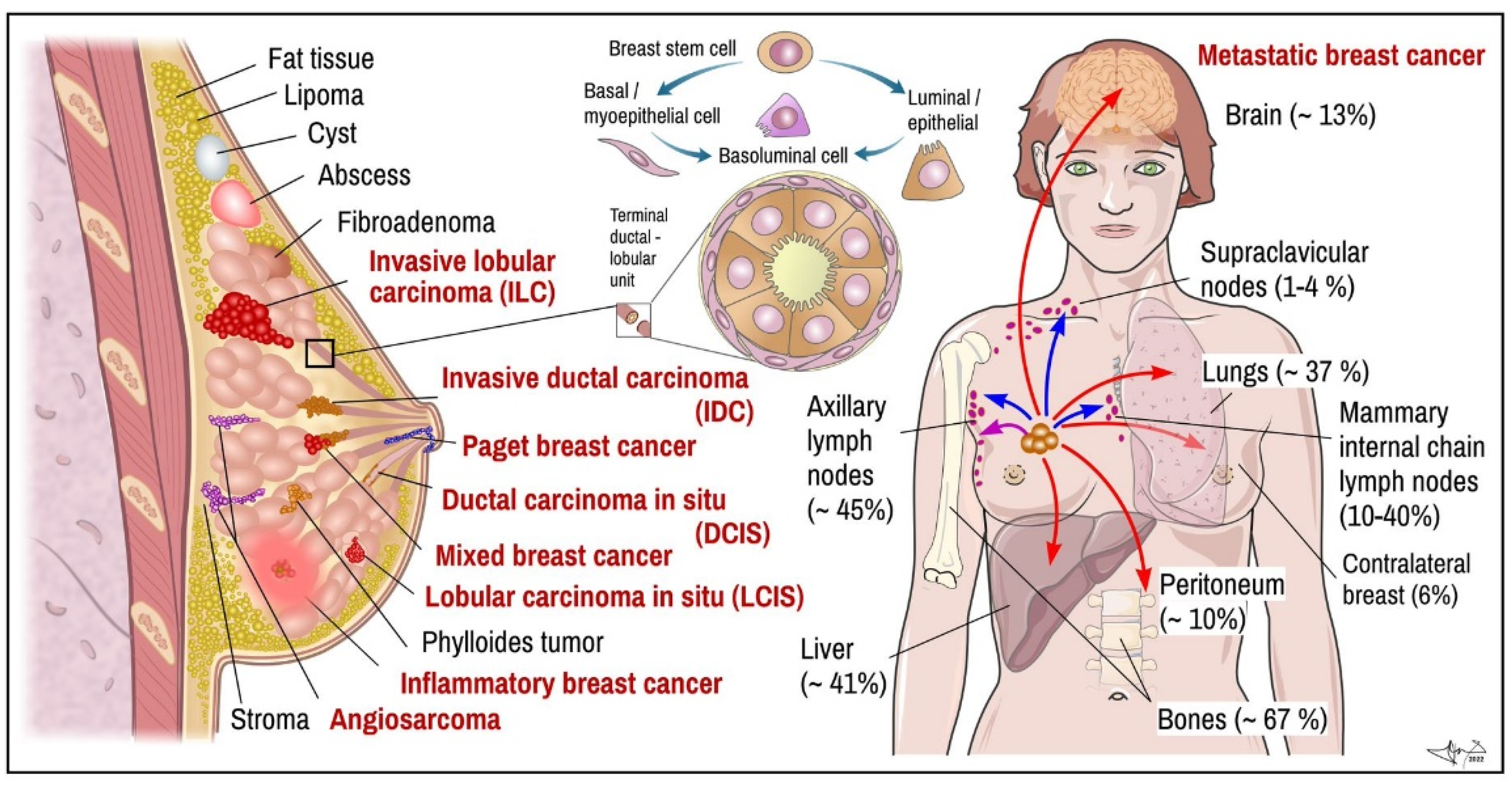 Cancers, Free Full-Text