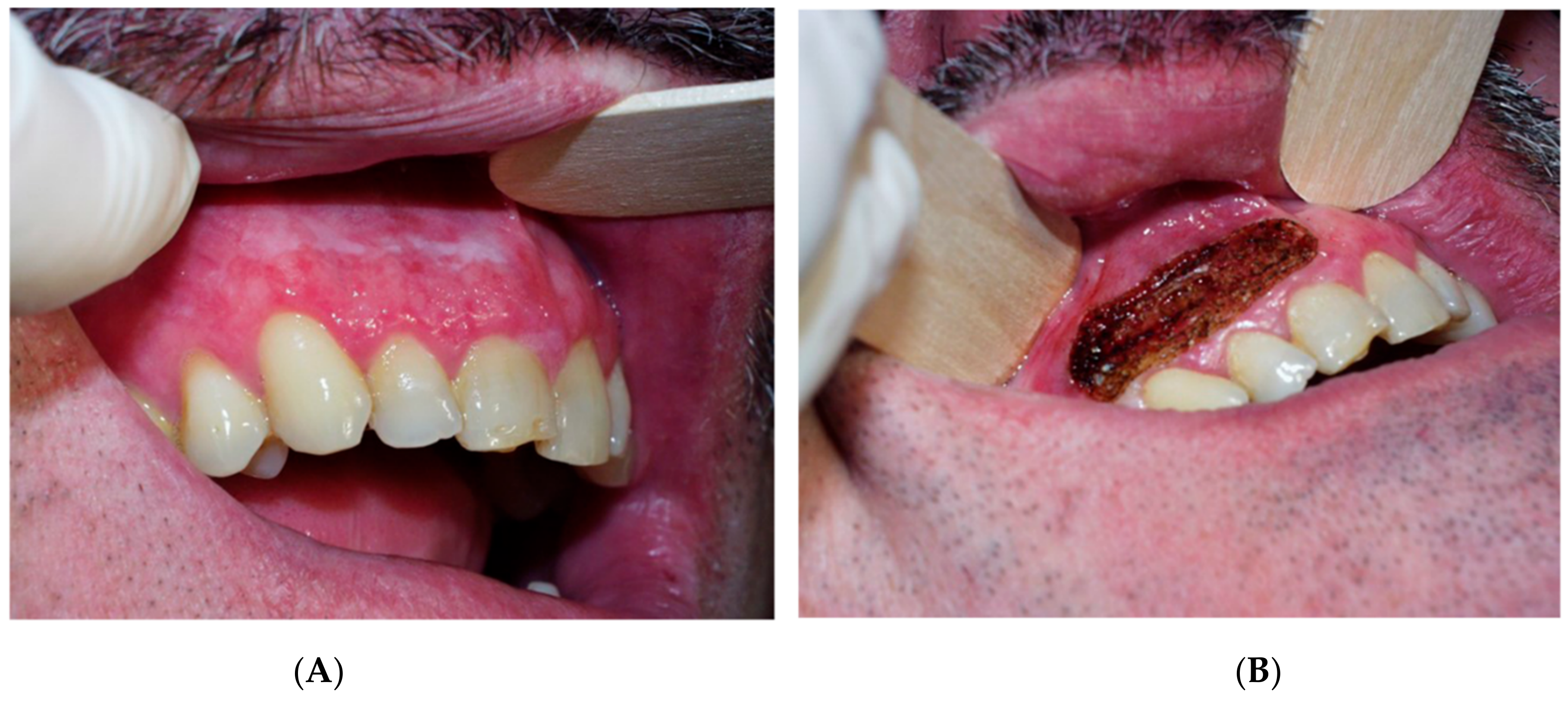 Cancers 14 05455 g002