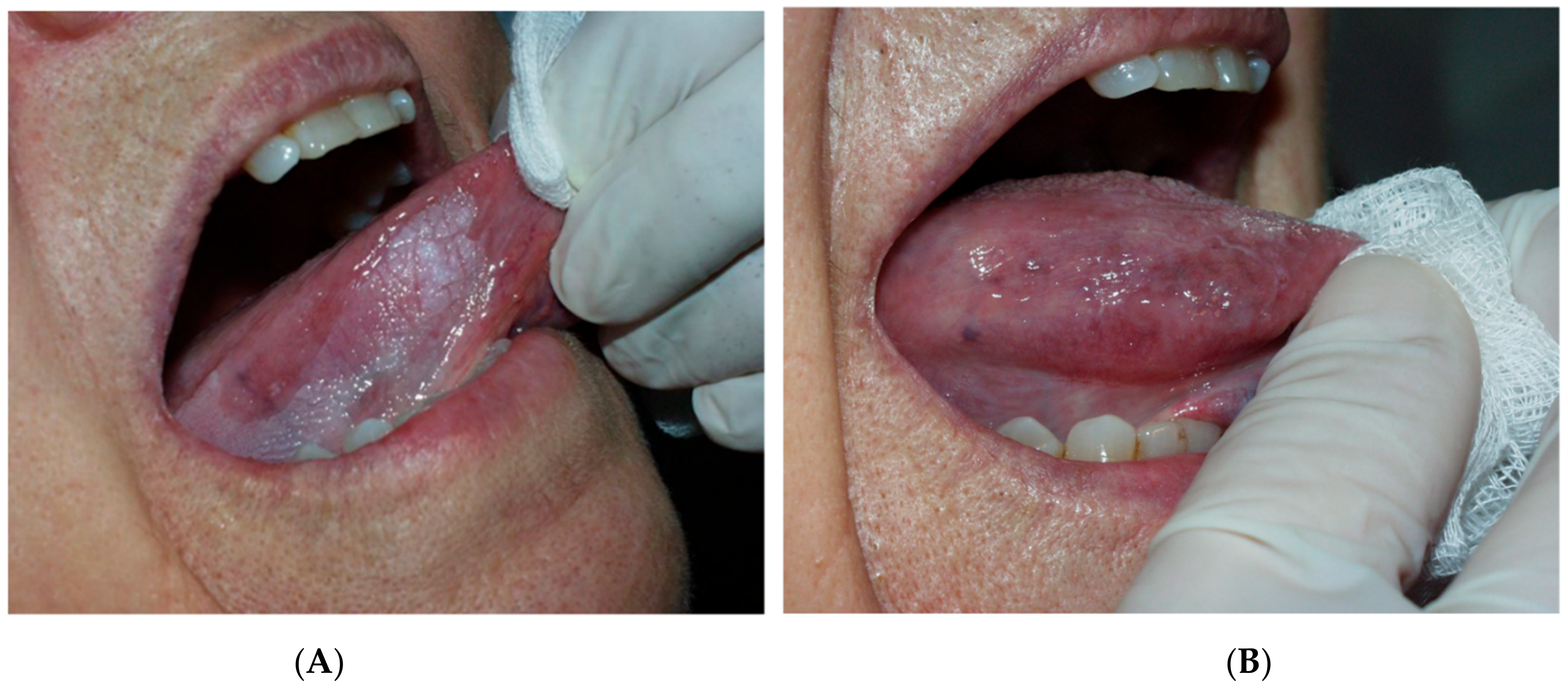 Cancers 14 05455 g003